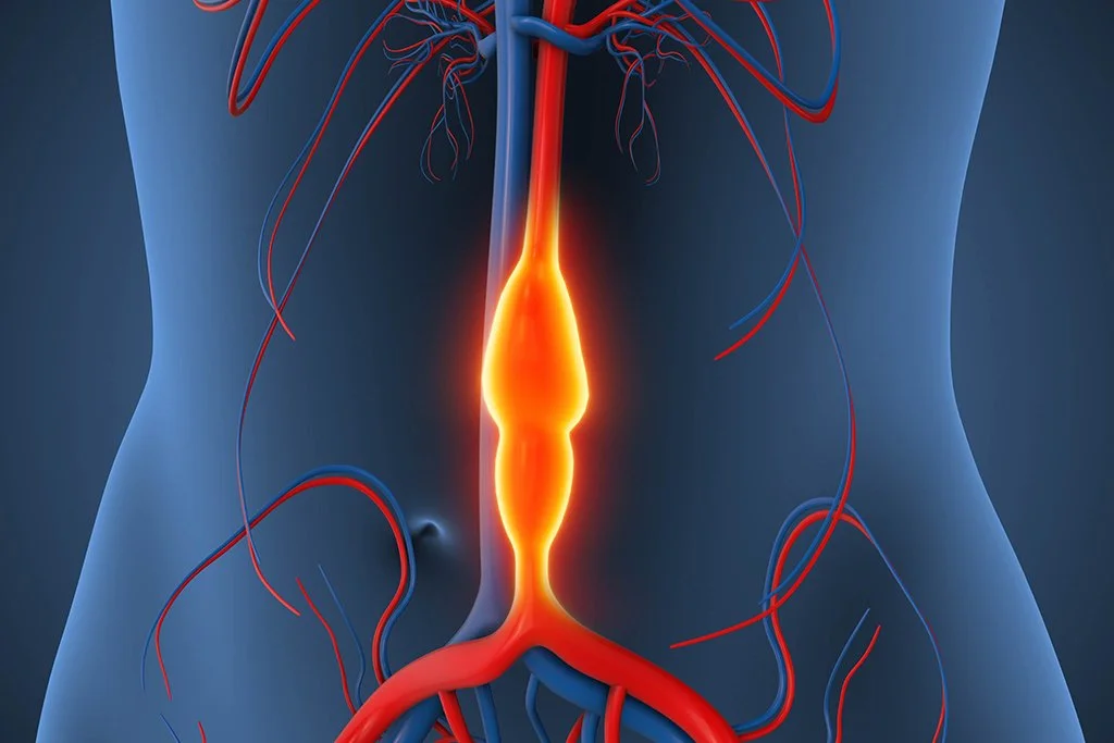 «L’aneurisma dell’aorta addominale è una patologia che richiede una sensibilizzazione continua»