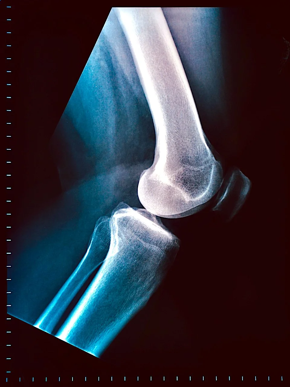 A Thousand Wordsthe x-ray files — BigbambooBIGBAMBOO PHOTO