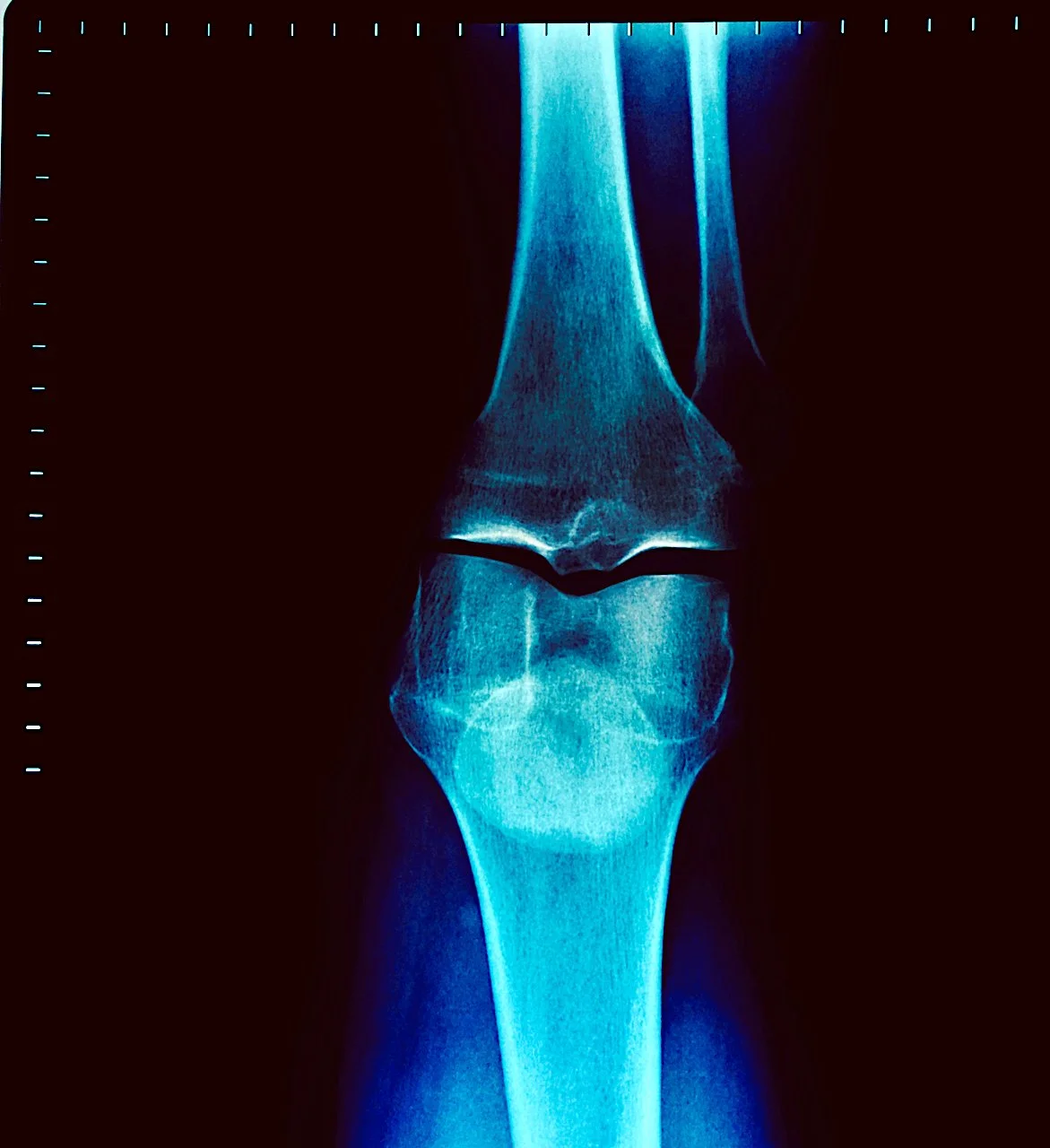 A Thousand Wordsx-ray files — BigbambooBIGBAMBOO PHOTO