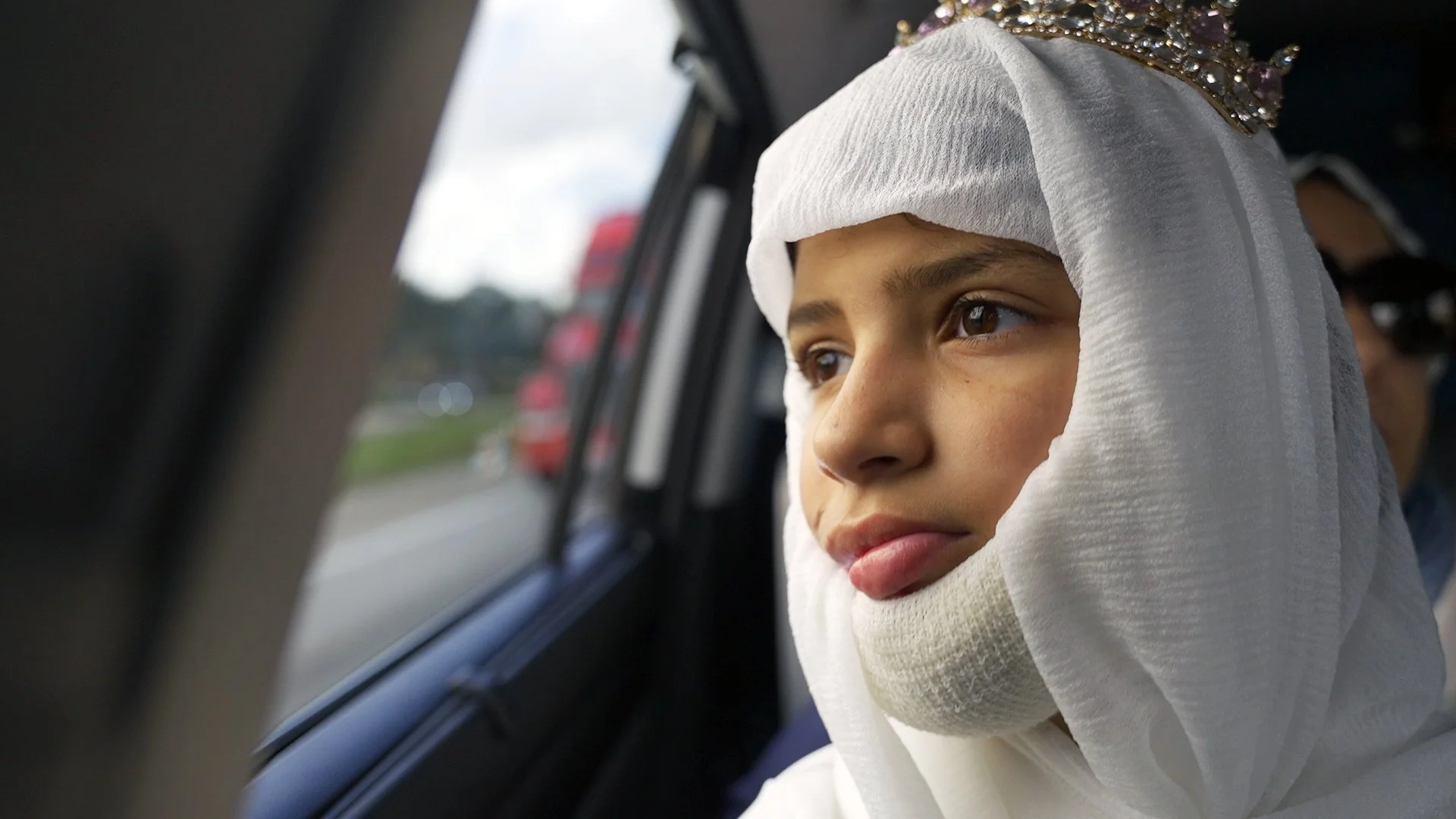 The Gaza girl whose face was 'ripped off' by an Israeli missile strike