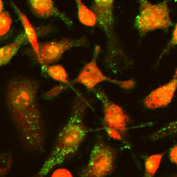 Cellulose nanocrystals (green) internalized by HeLa cells (red)