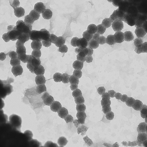 Reactive zerovalent iron nanoparticles are used for remediation of contaminated sites