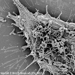 Scanning electron microscopy image of a canine kidney cell with pathogenic bacteria attached