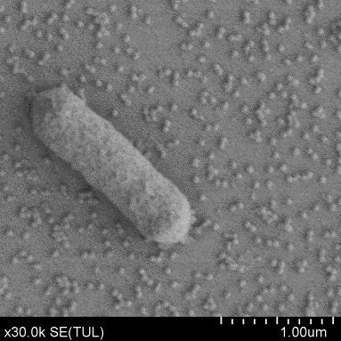 Bacterial cell captured on a phage-coated surface