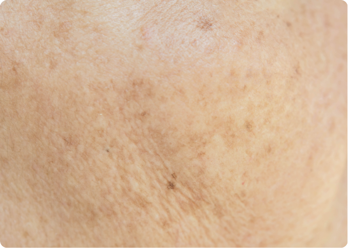 The Dermatology Institute of Victoria | Melbourne Dermatologists— Why ...
