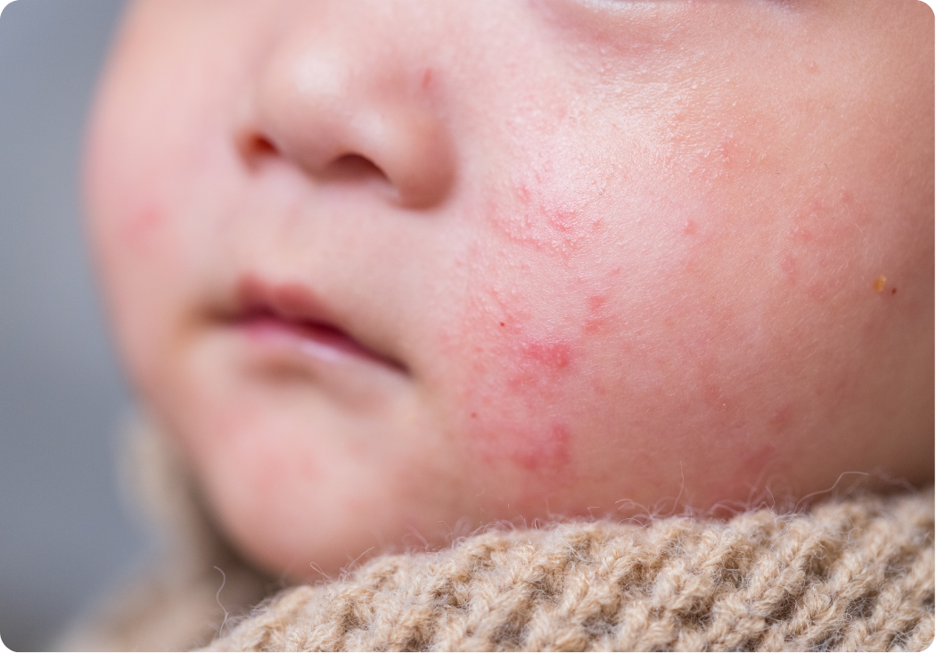 The Dermatology Institute of Victoria | Melbourne Dermatologists— Can ...