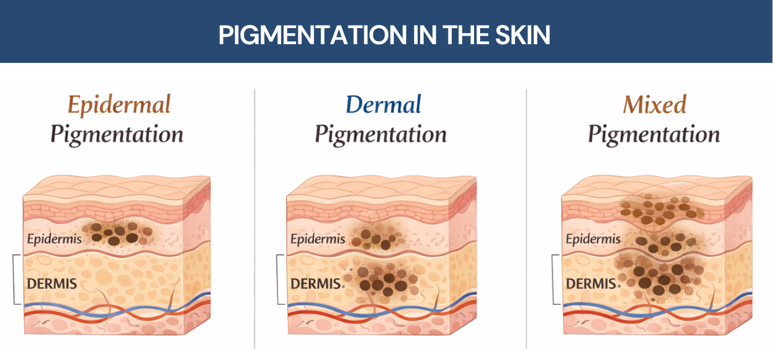 Cellular Pigmentation The Dermatology Institute of Victoria | Melbourne Dermatologists— Why ...