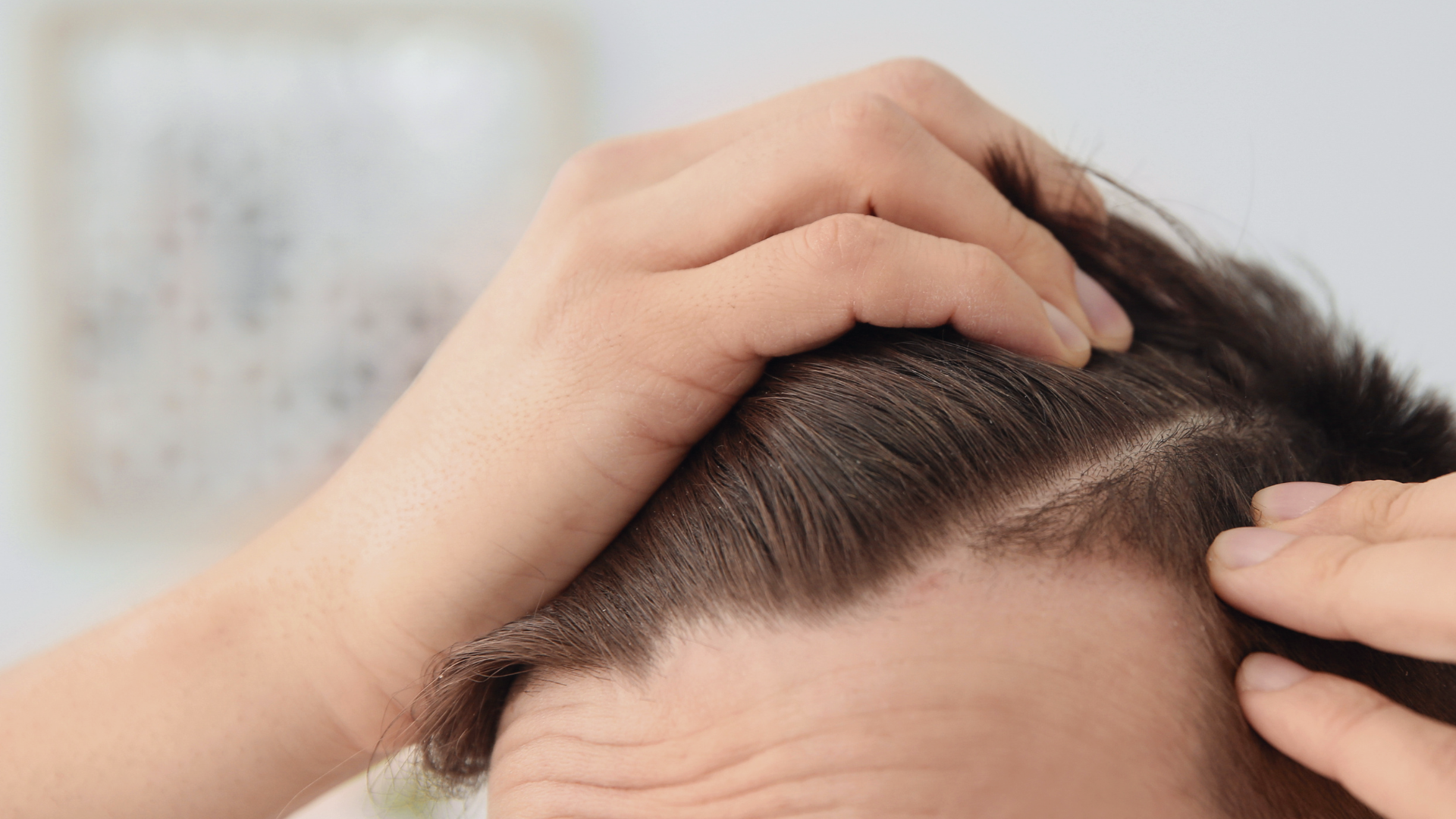 What does a dermatologist look for during a hair loss consultation?