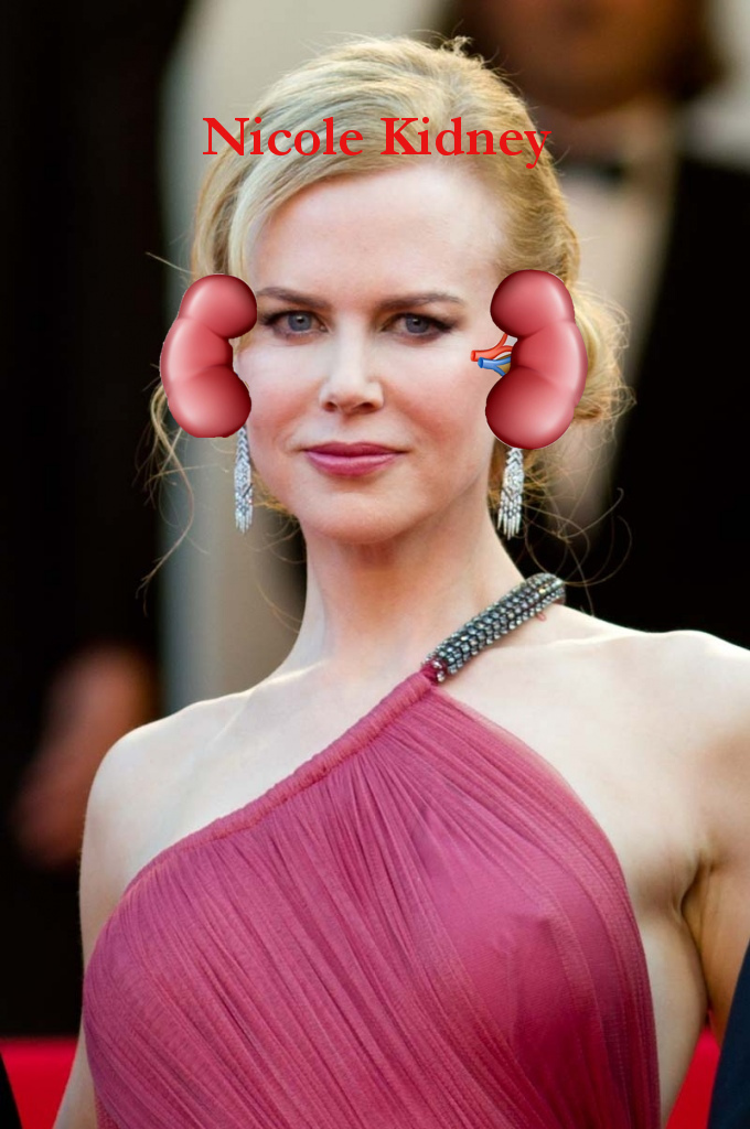 Nicole Kidney