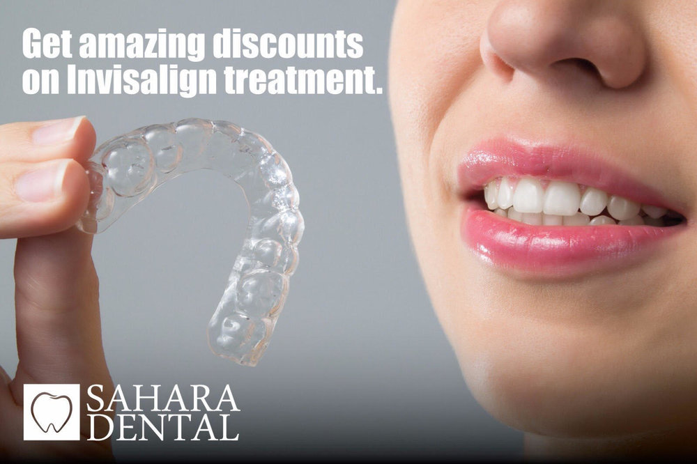 Invisalign sale2.jpg