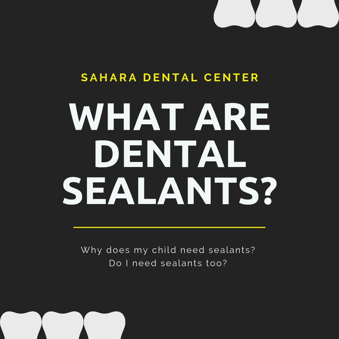 Sealants.png