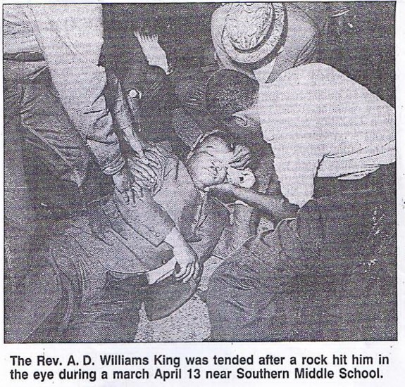 A D Struck in the eye in KY.jpg