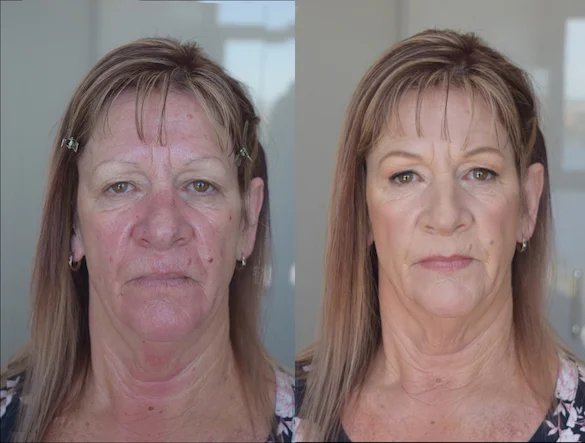 before-and-after-makeup-mother-natural-.jpg