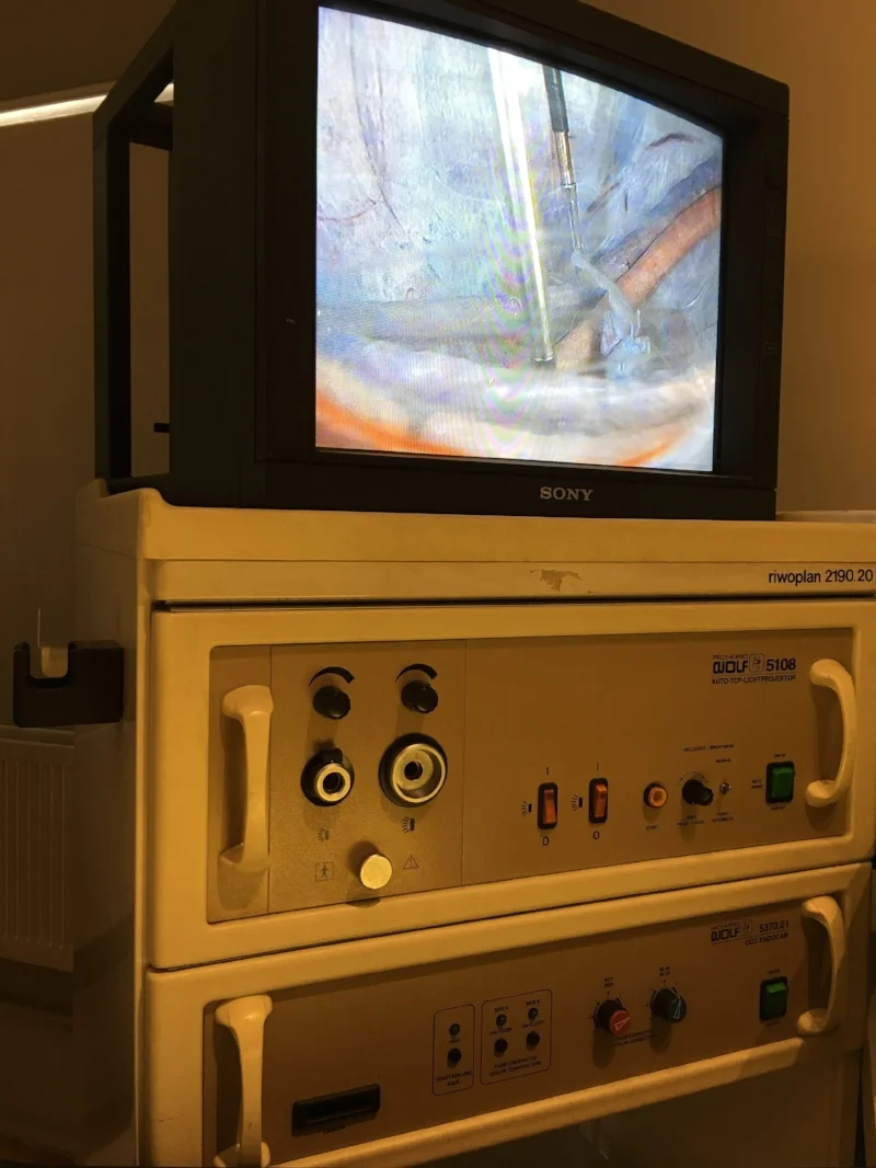 Laparoscopy machine on loan from NHS Worcestershire on whhich first keyhole surgery was done in 1990 