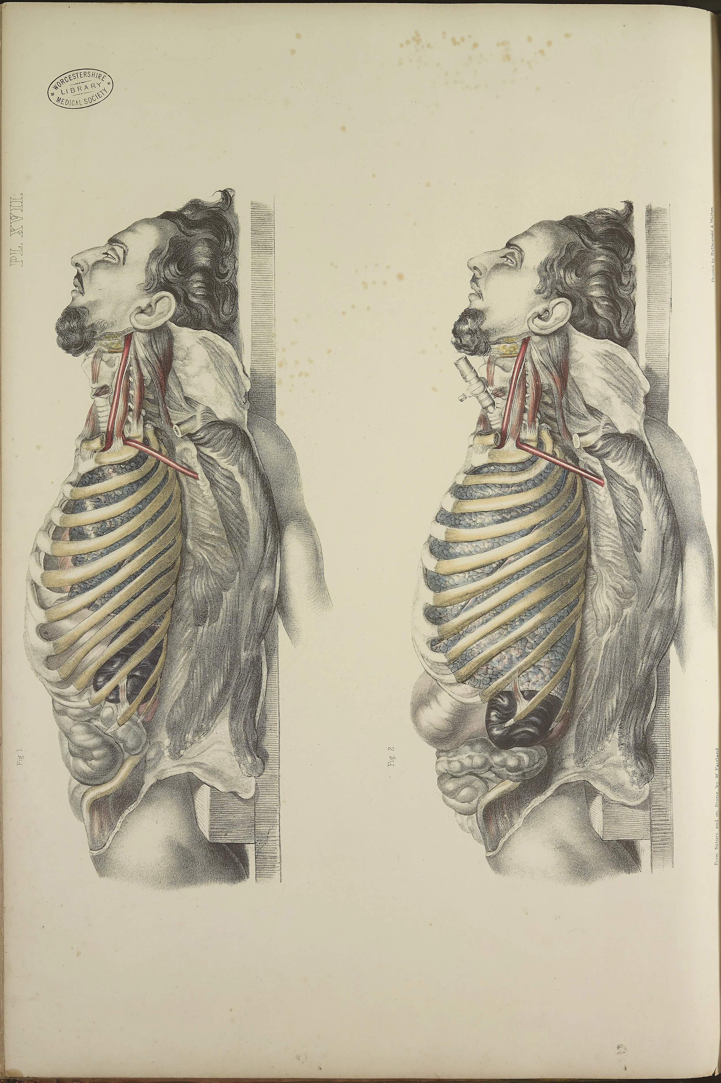RM0162_51.jpg