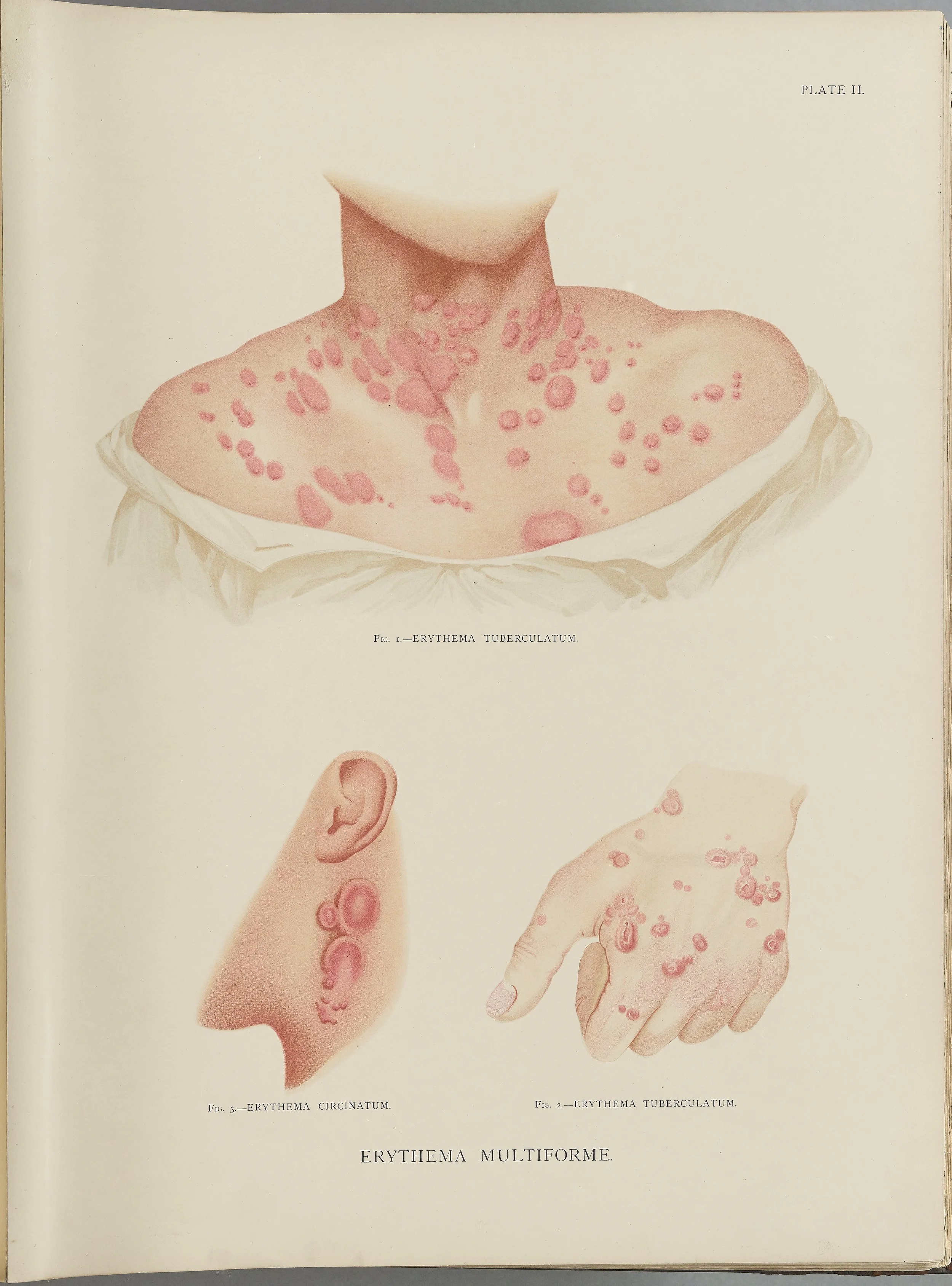 RM0164(Vol.i)_11.jpg