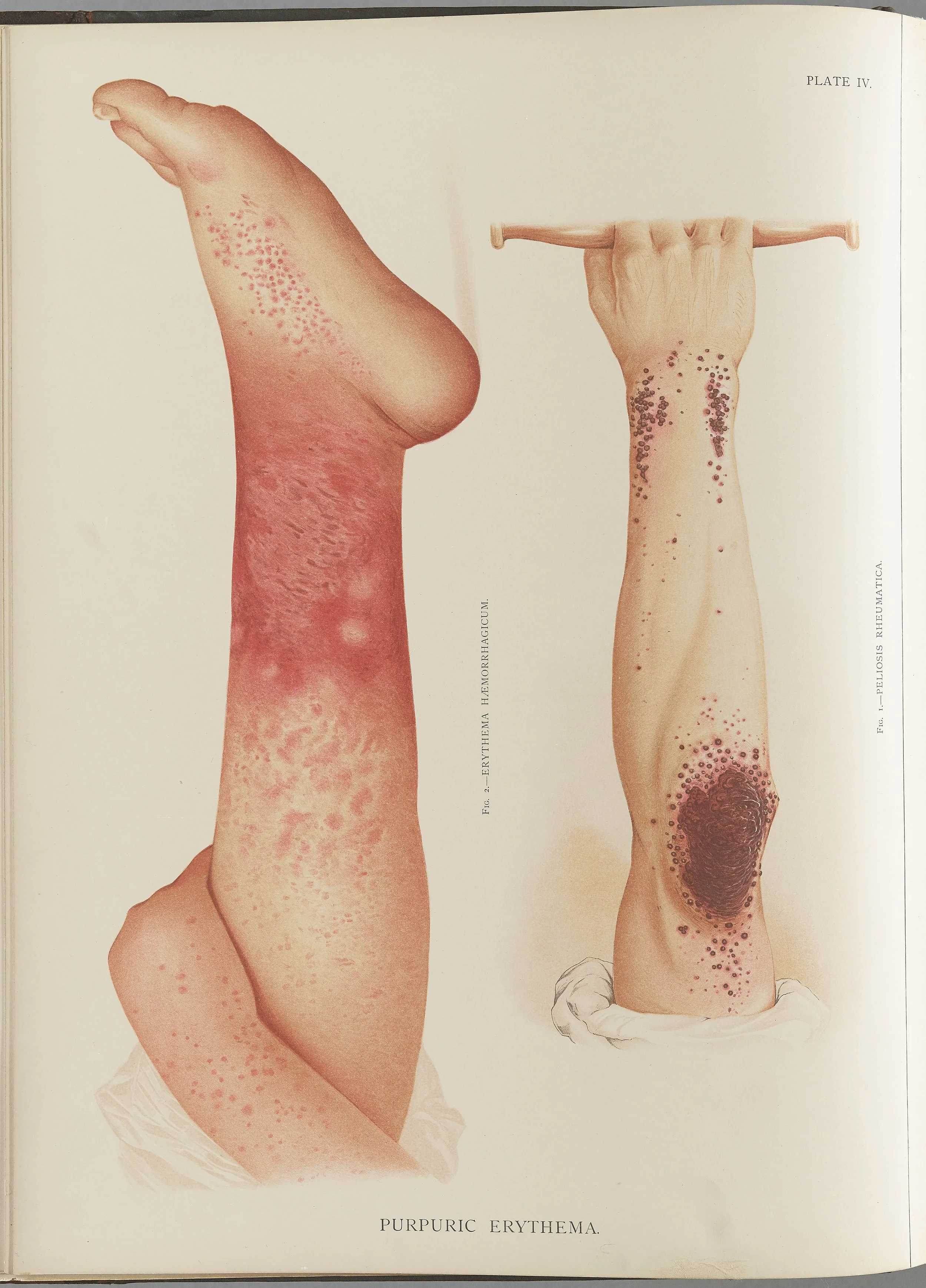 RM0164(Vol.i)_15.jpg