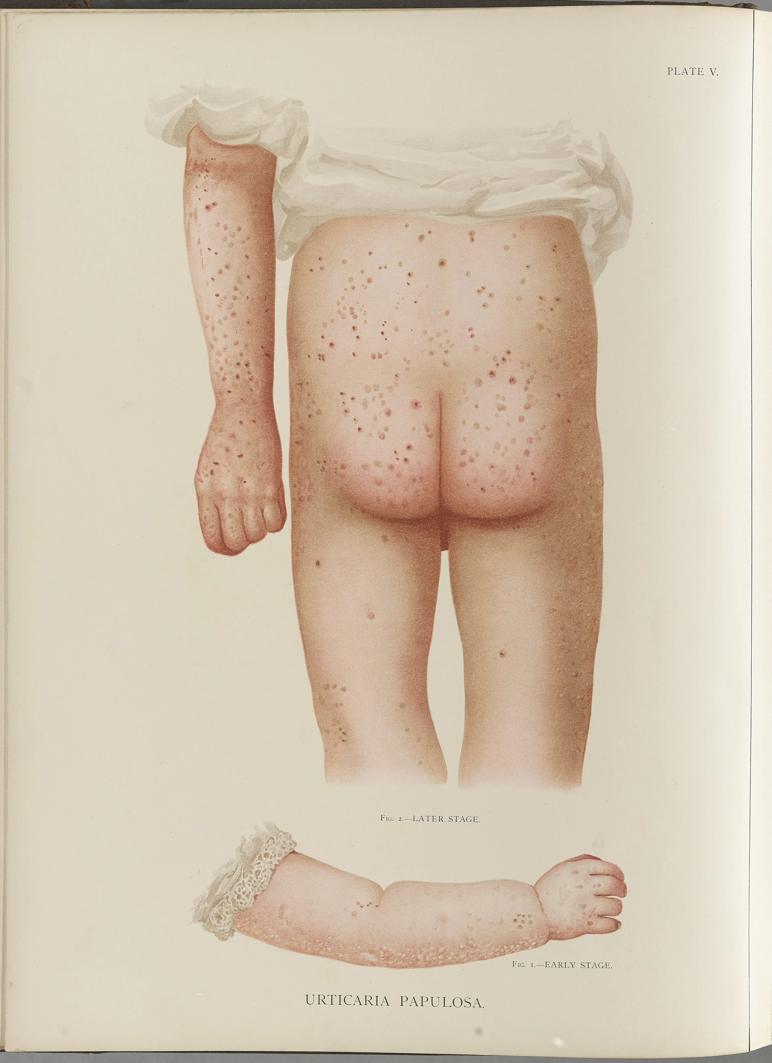 RM0164(Vol.i)_18.jpg