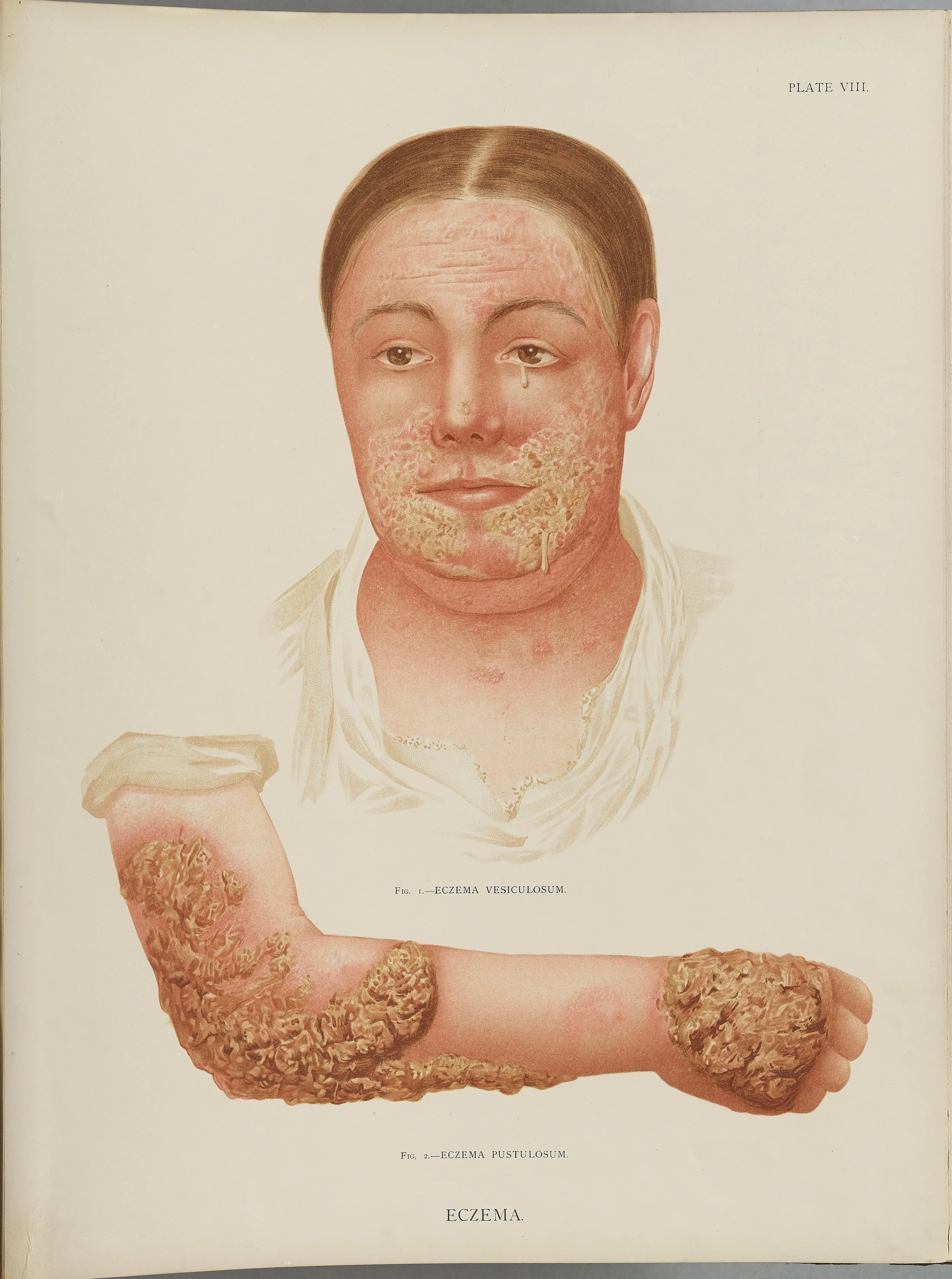 RM0164(Vol.i)_27.jpg