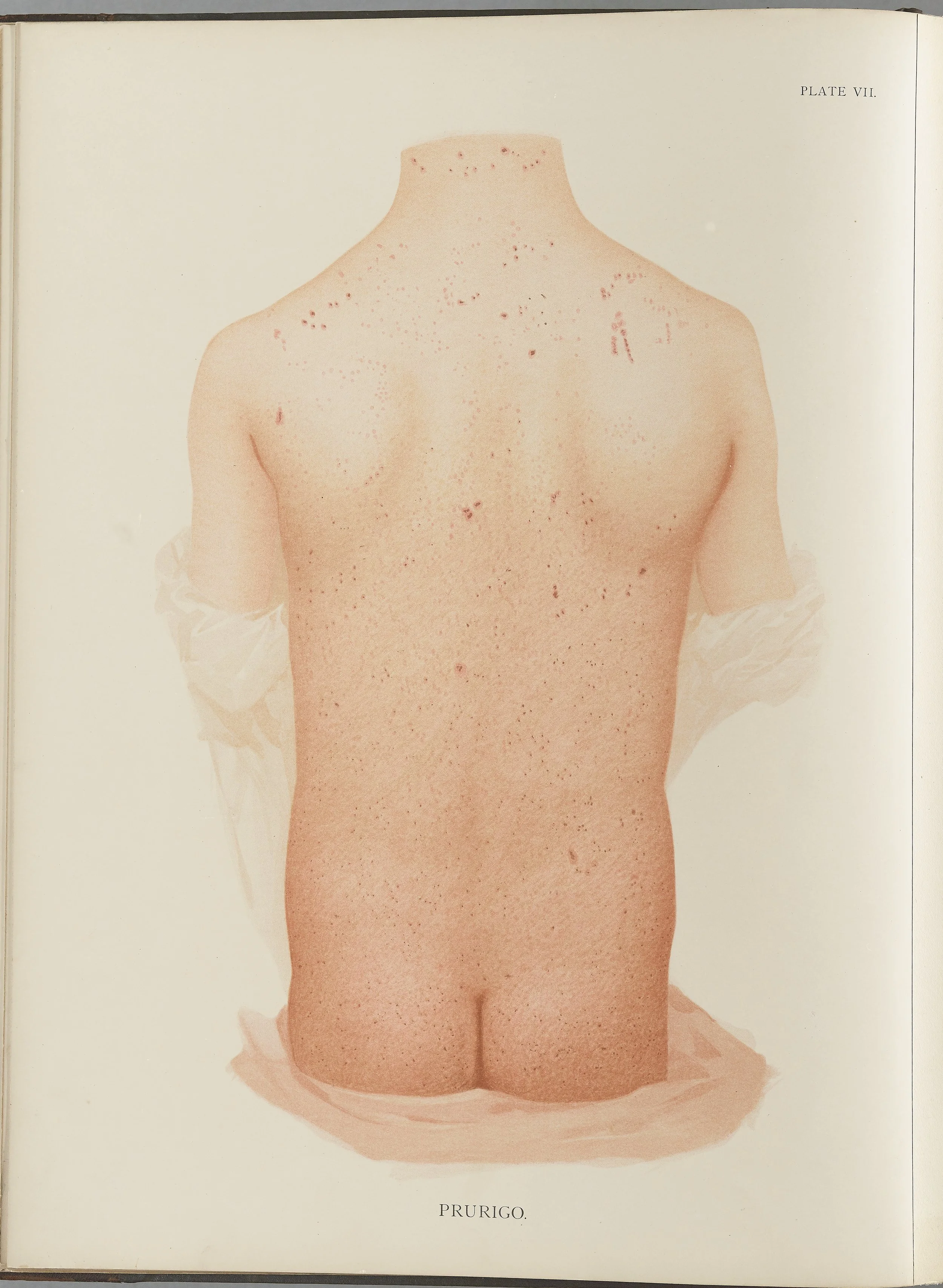 RM0164(Vol.i)_23.jpg