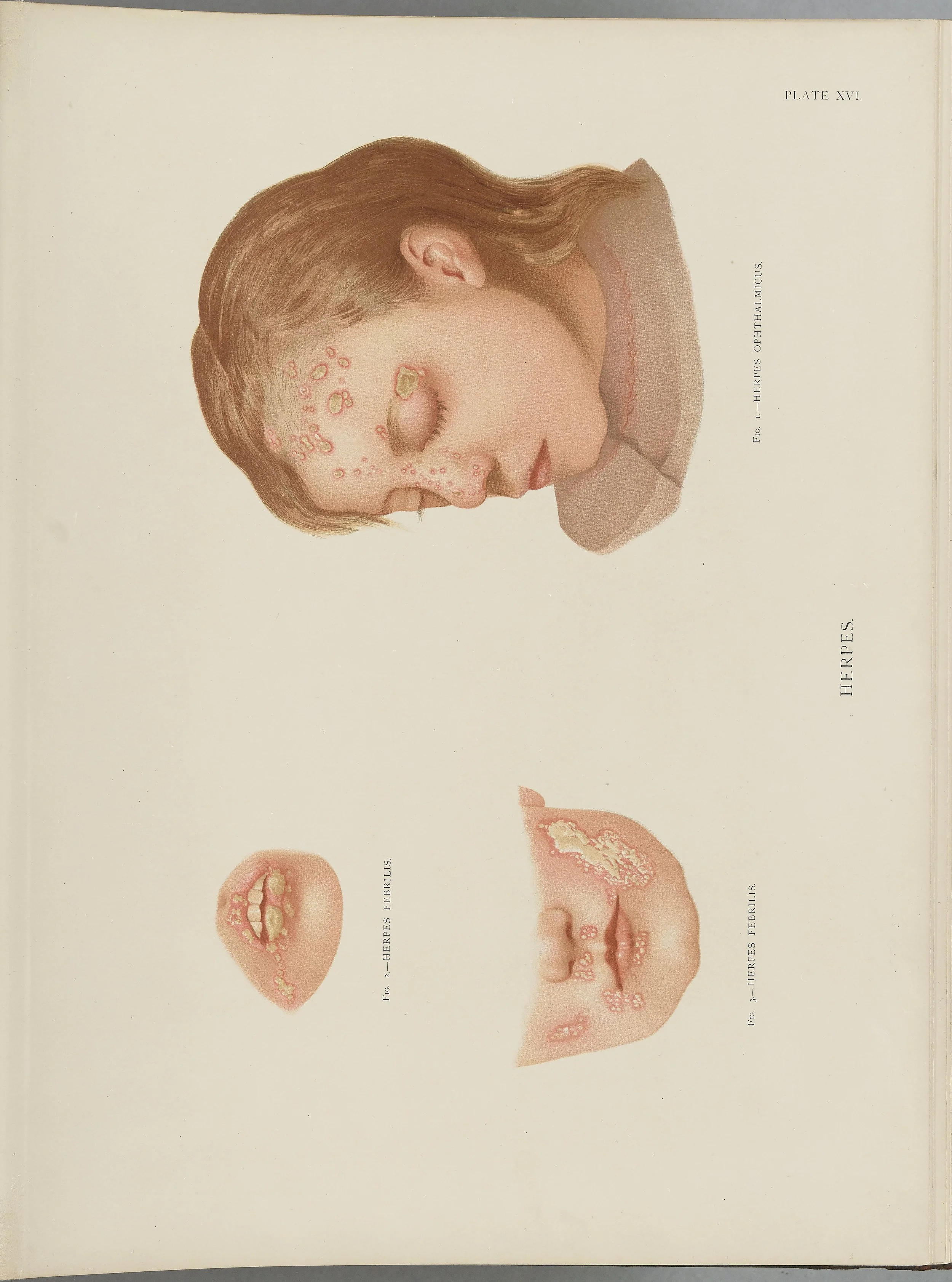 RM0164(Vol.i)_45.jpg