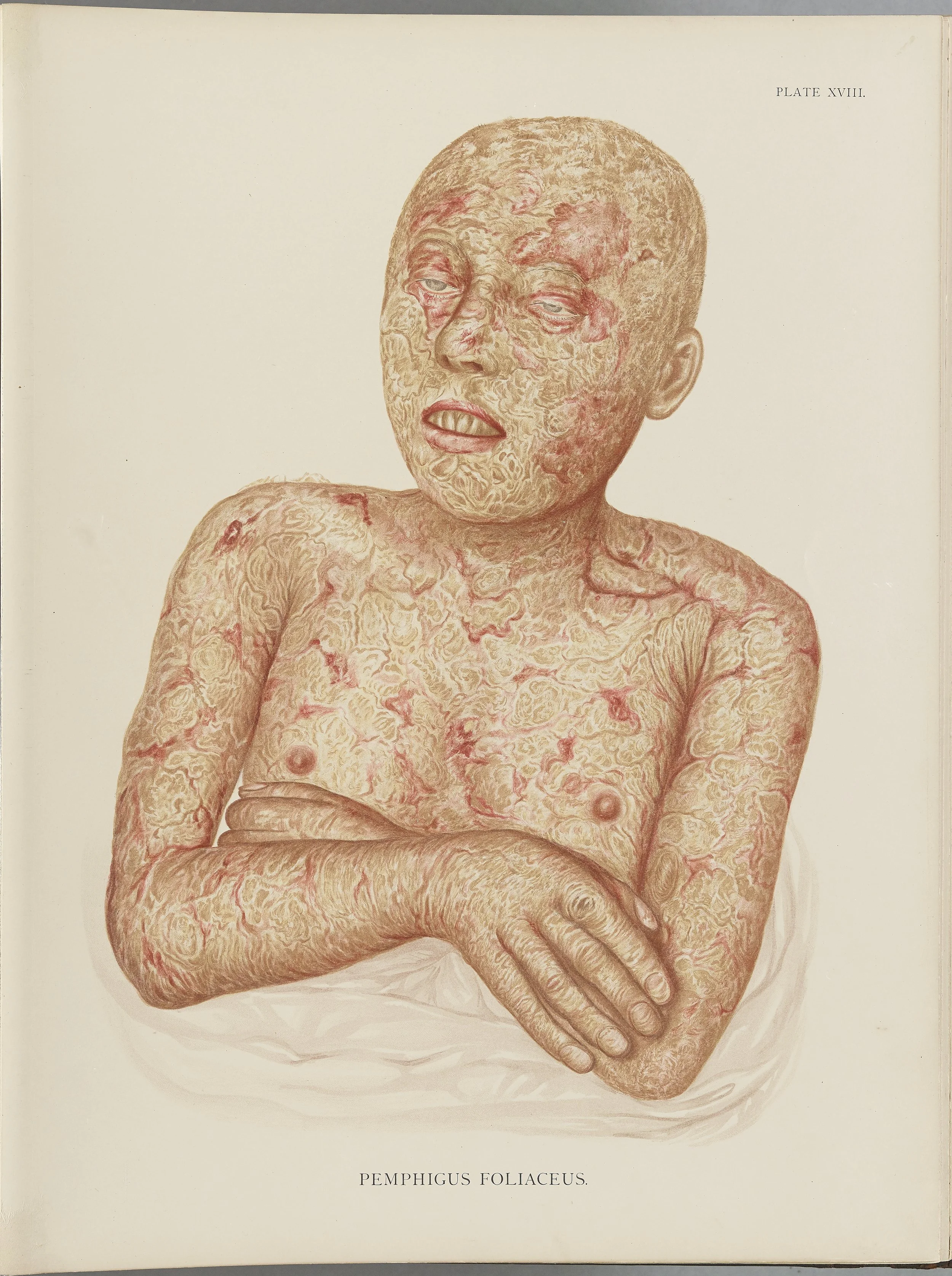 RM0164(Vol.i)_50.jpg