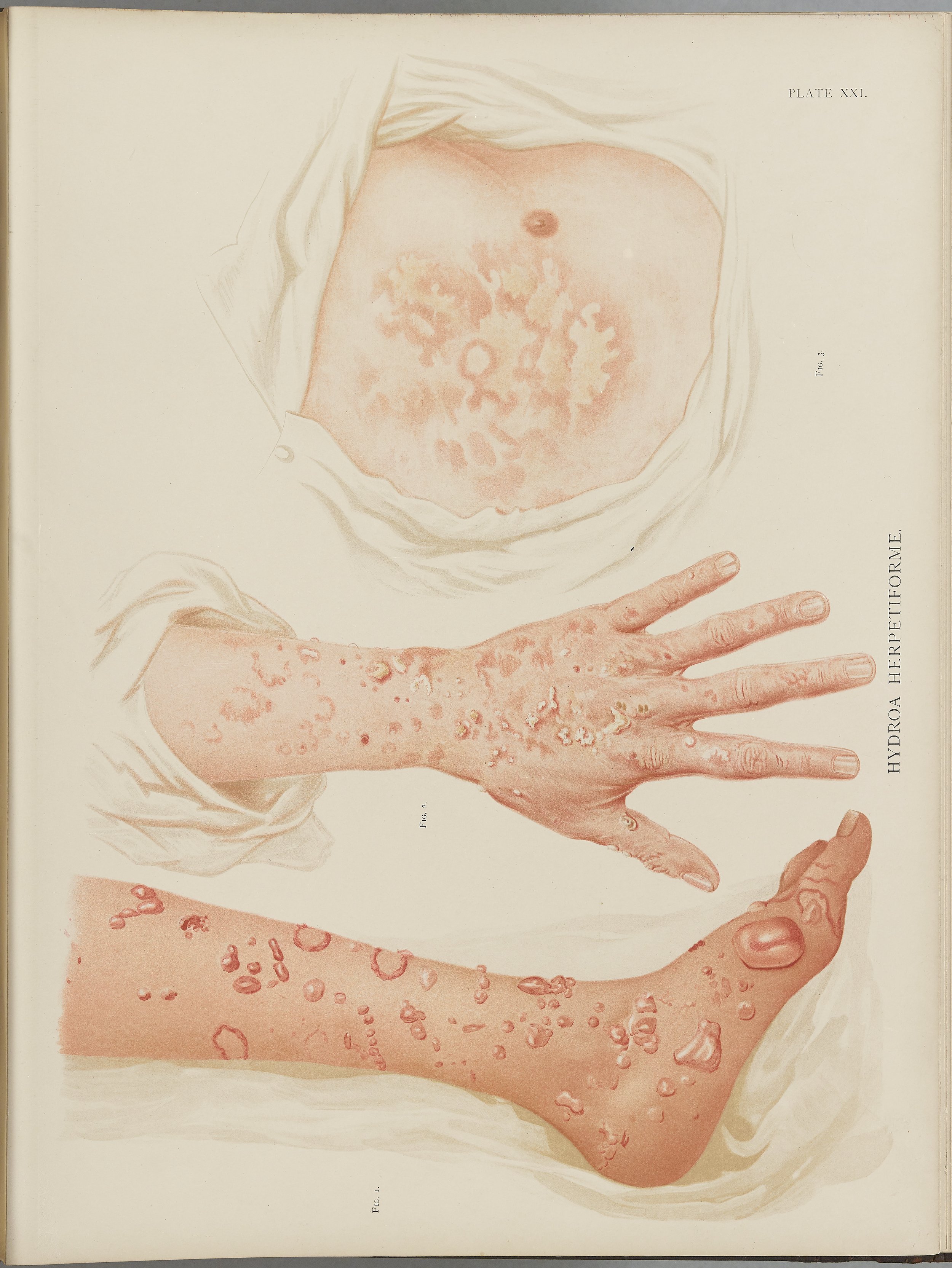 RM0164(Vol.i)_60.jpg