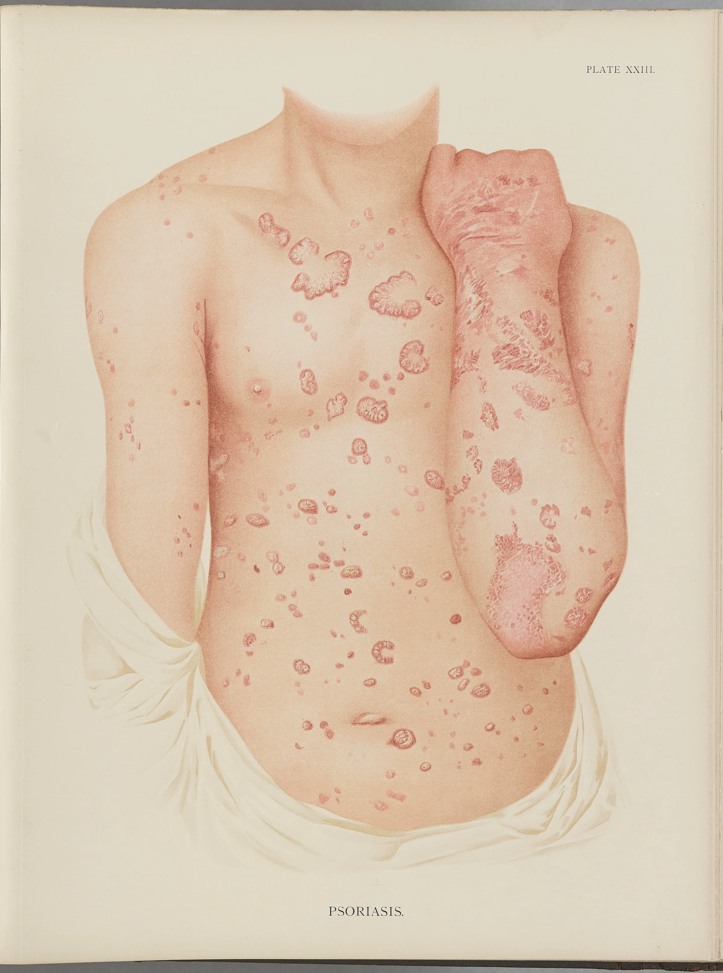 RM0164(Vol.i)_66.jpg