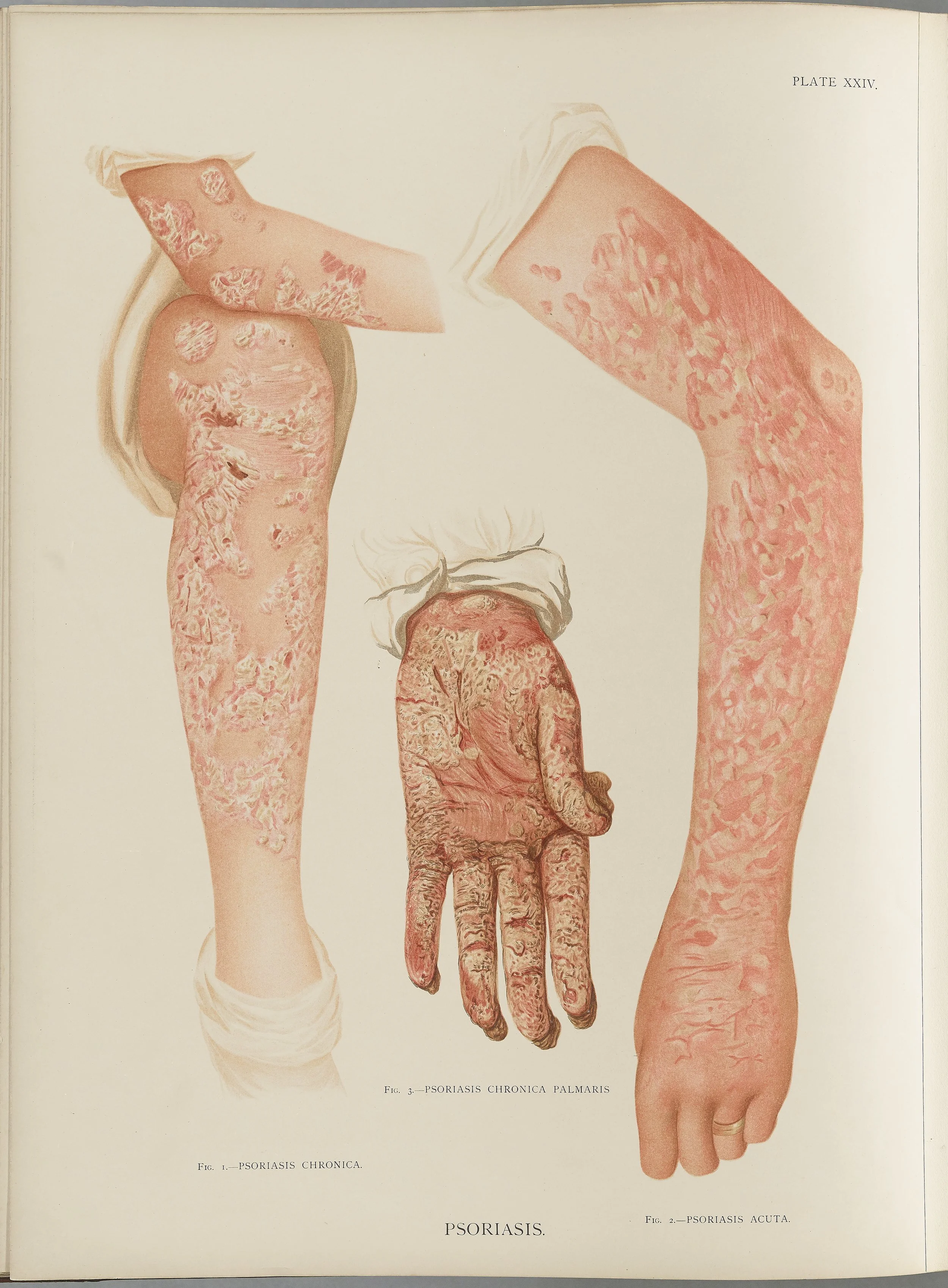 RM0164(Vol.i)_67.jpg