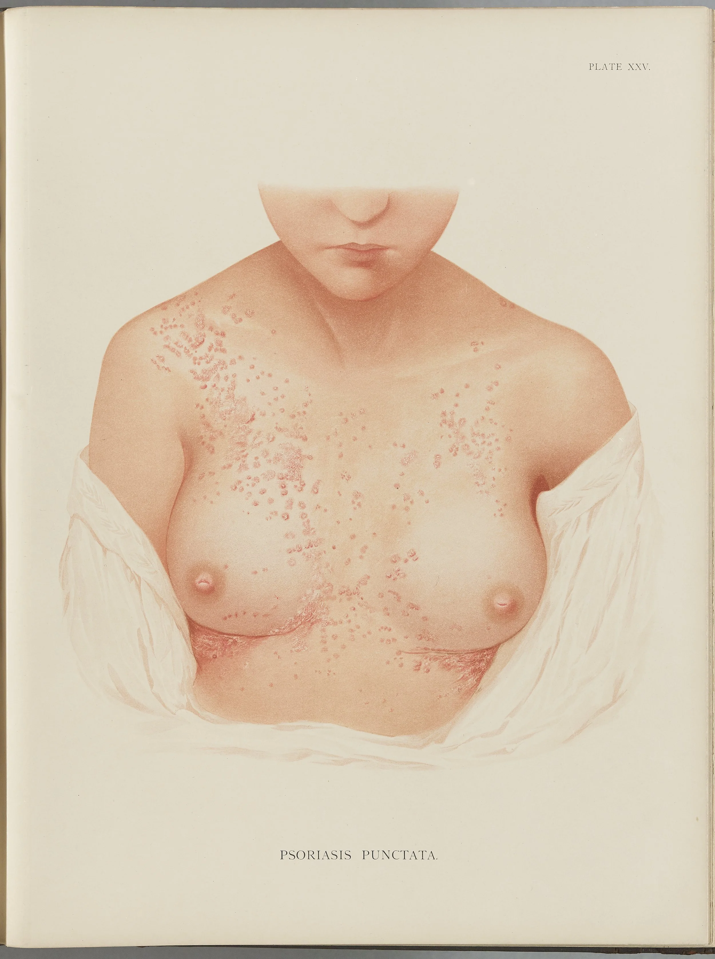 RM0164(Vol.i)_71.jpg