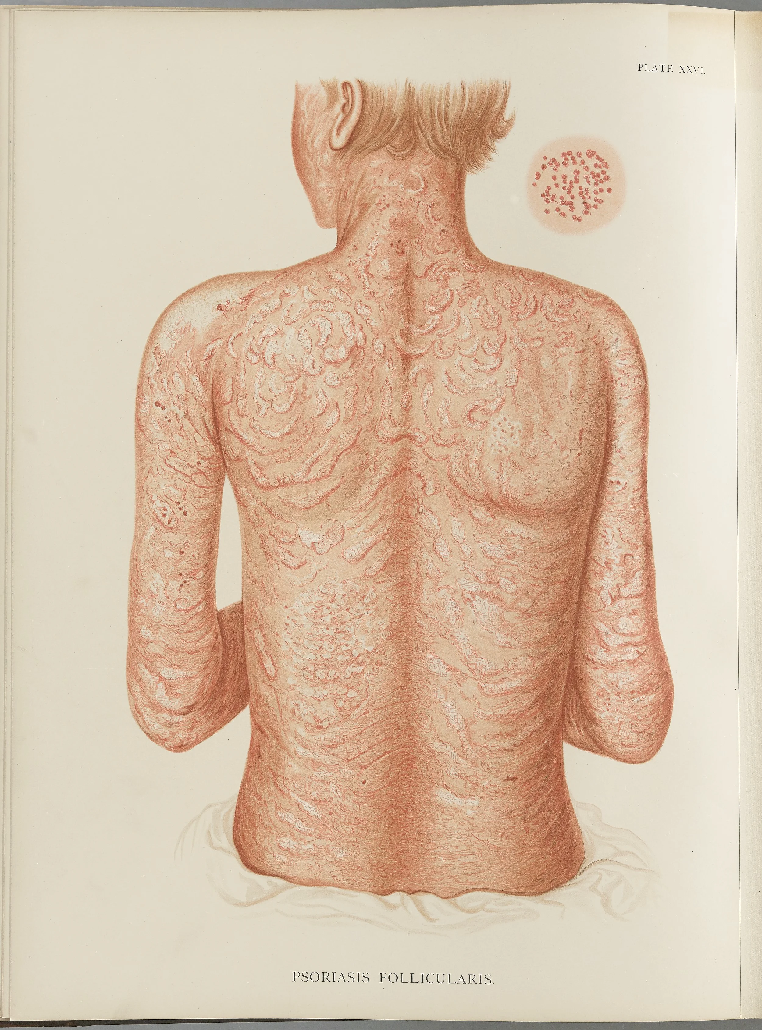 RM0164(Vol.i)_72.jpg