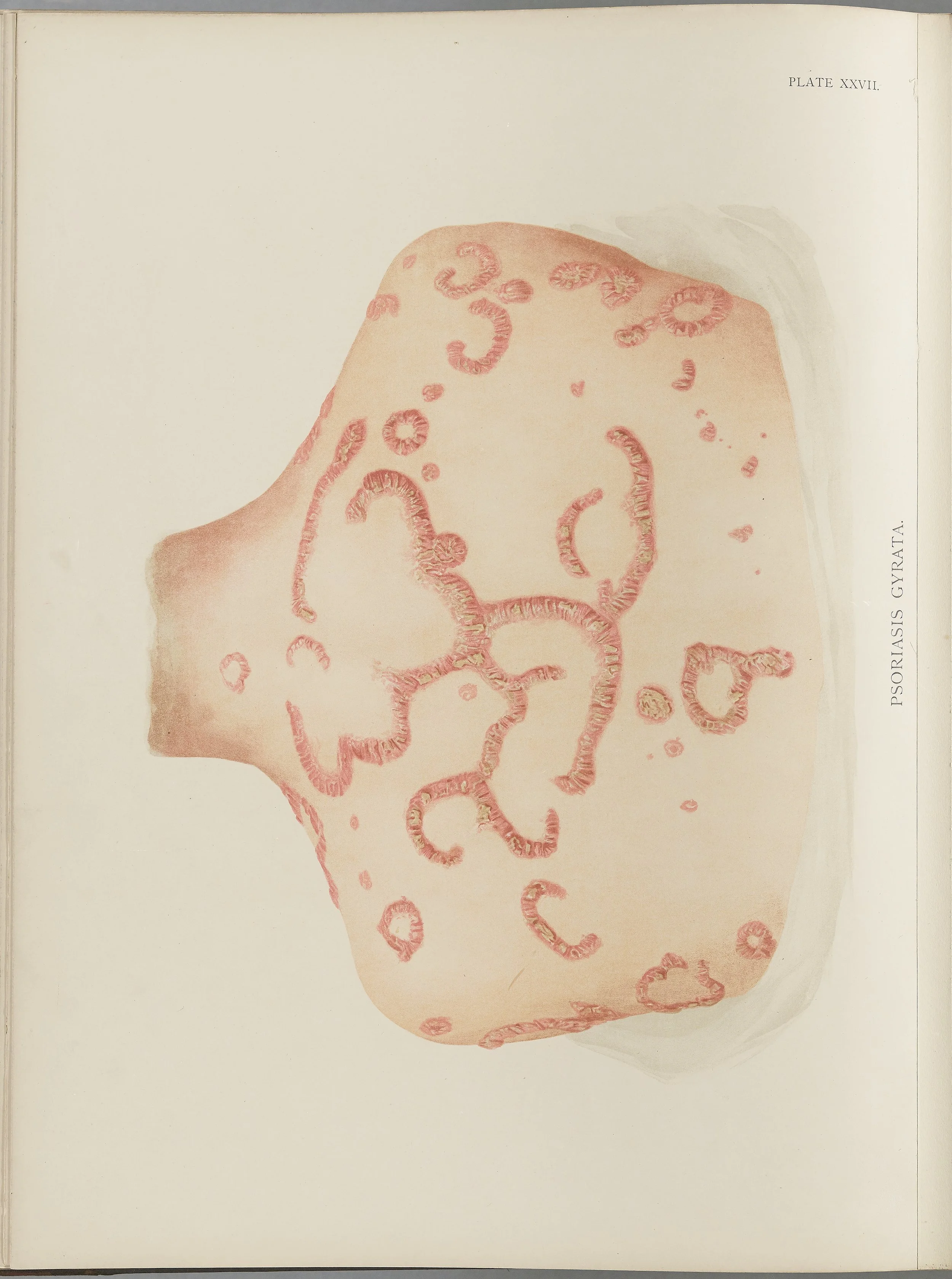 RM0164(Vol.i)_76.jpg