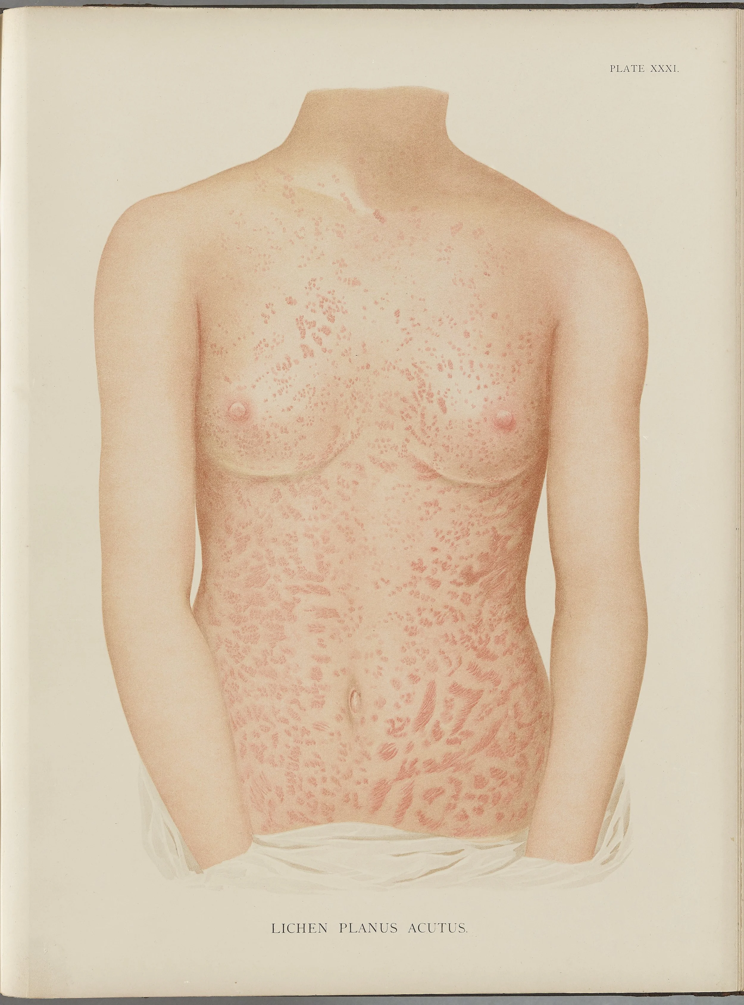 RM0164(Vol.i)_86.jpg