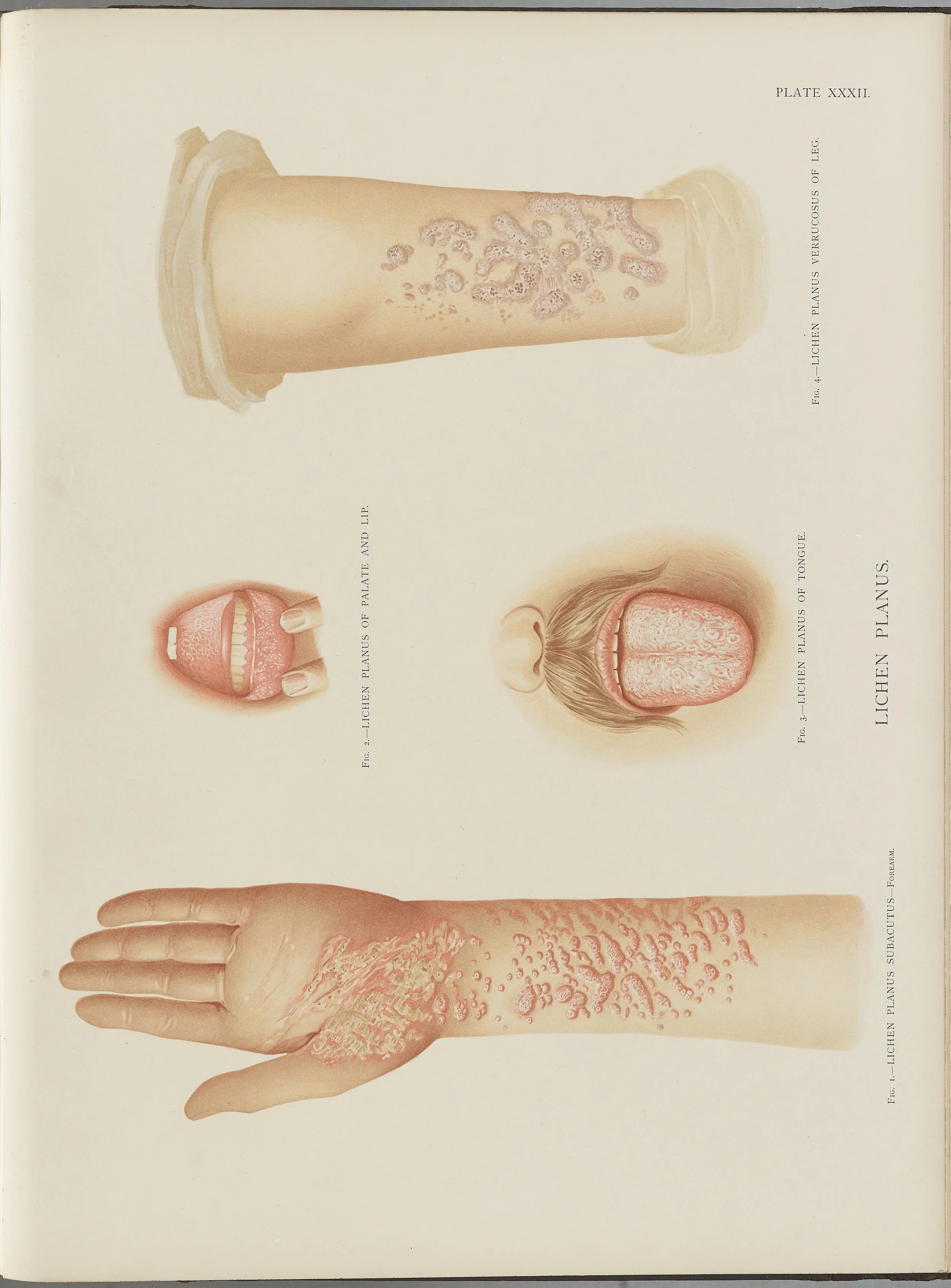 RM0164(Vol.i)_89.jpg
