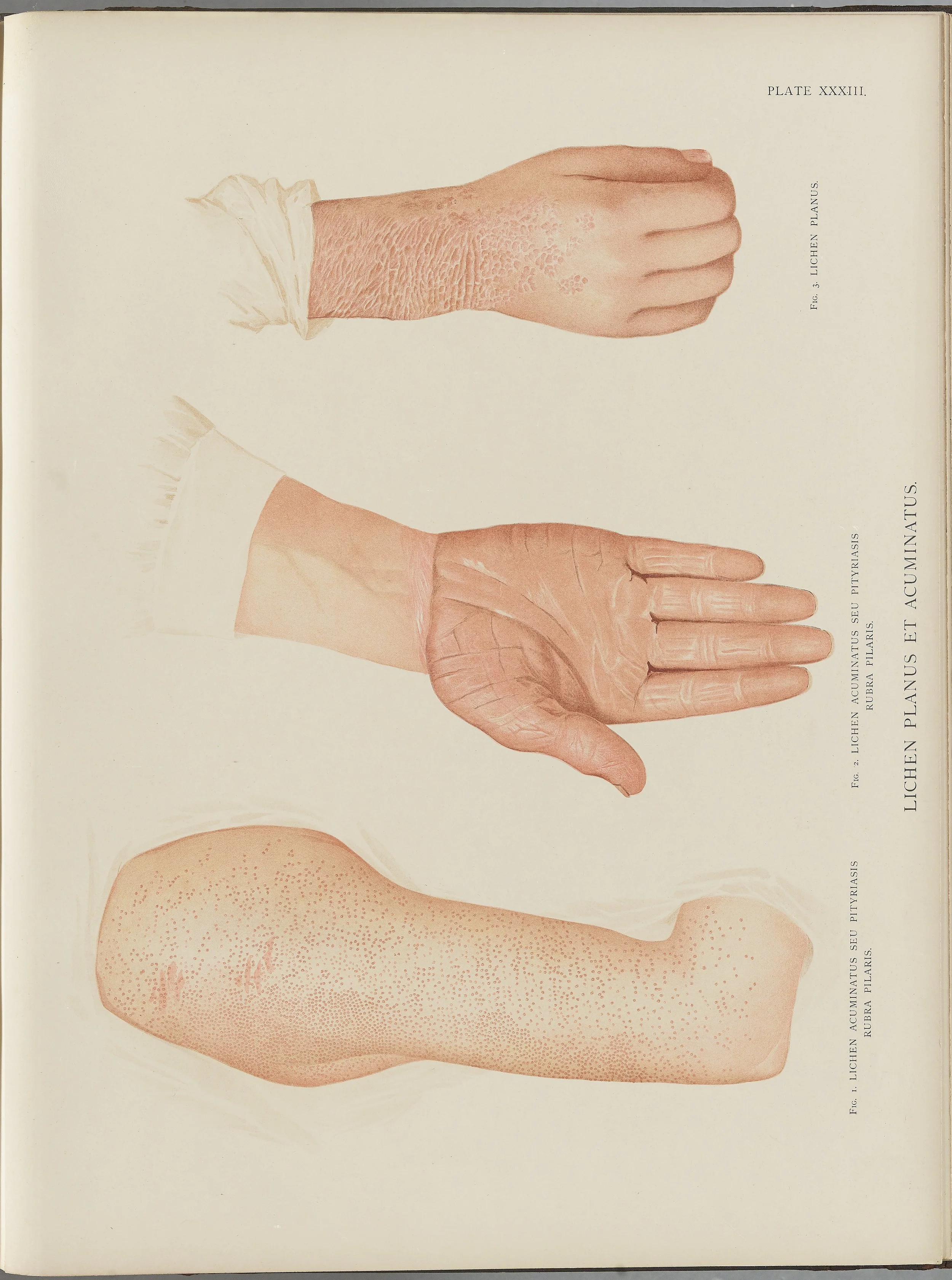 RM0164(Vol.i)_92.jpg