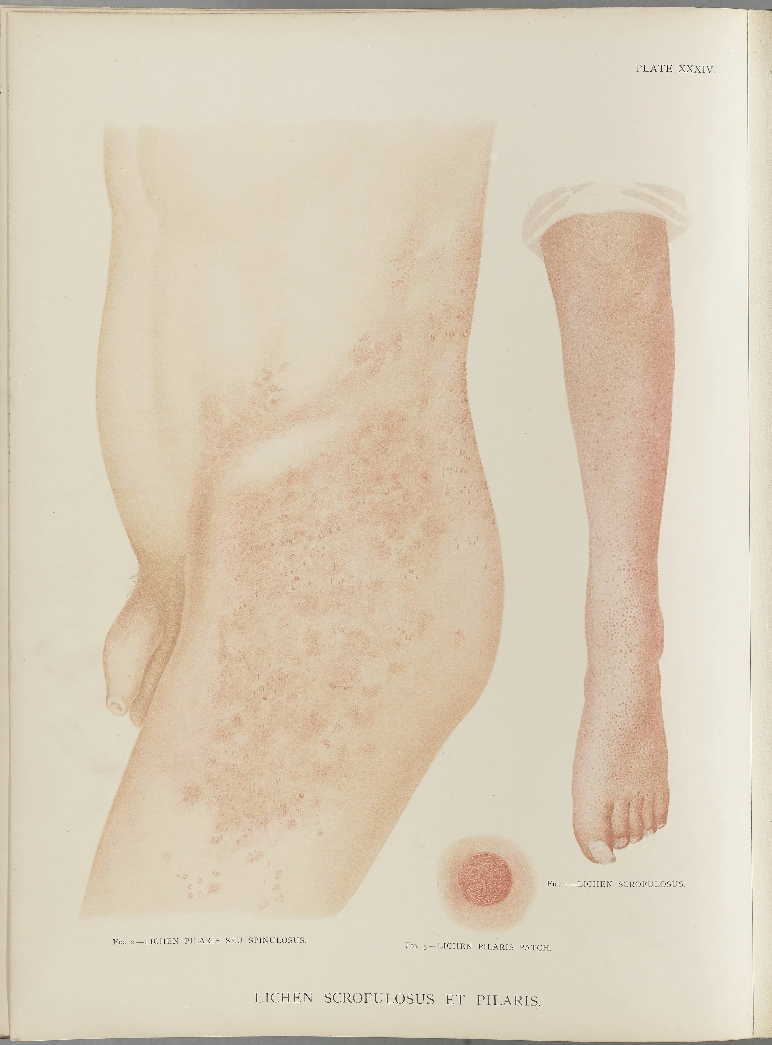RM0164(Vol.i)_94.jpg