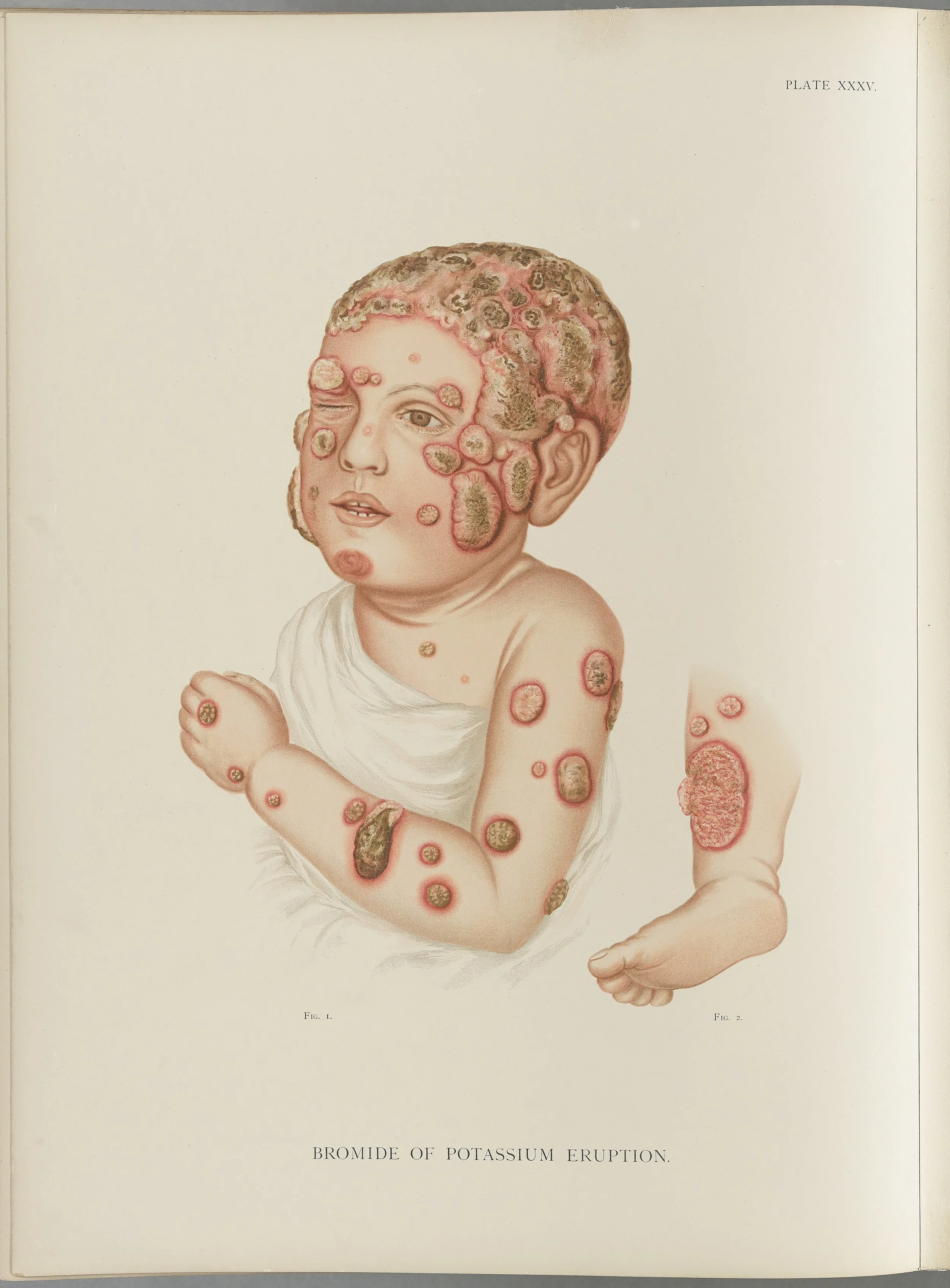 RM0164(Vol.i)_97.jpg