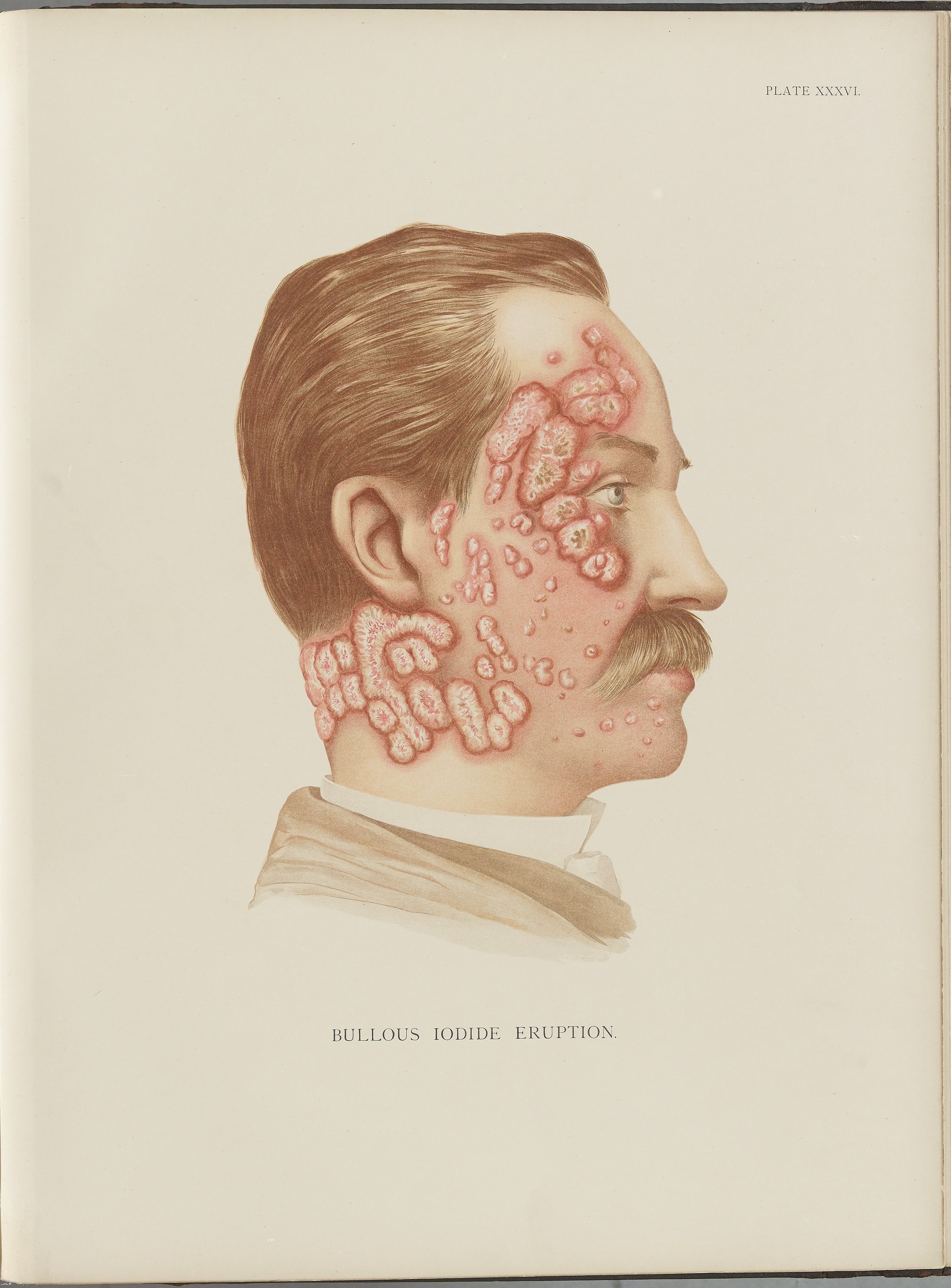 RM0164(Vol.i)_101.jpg
