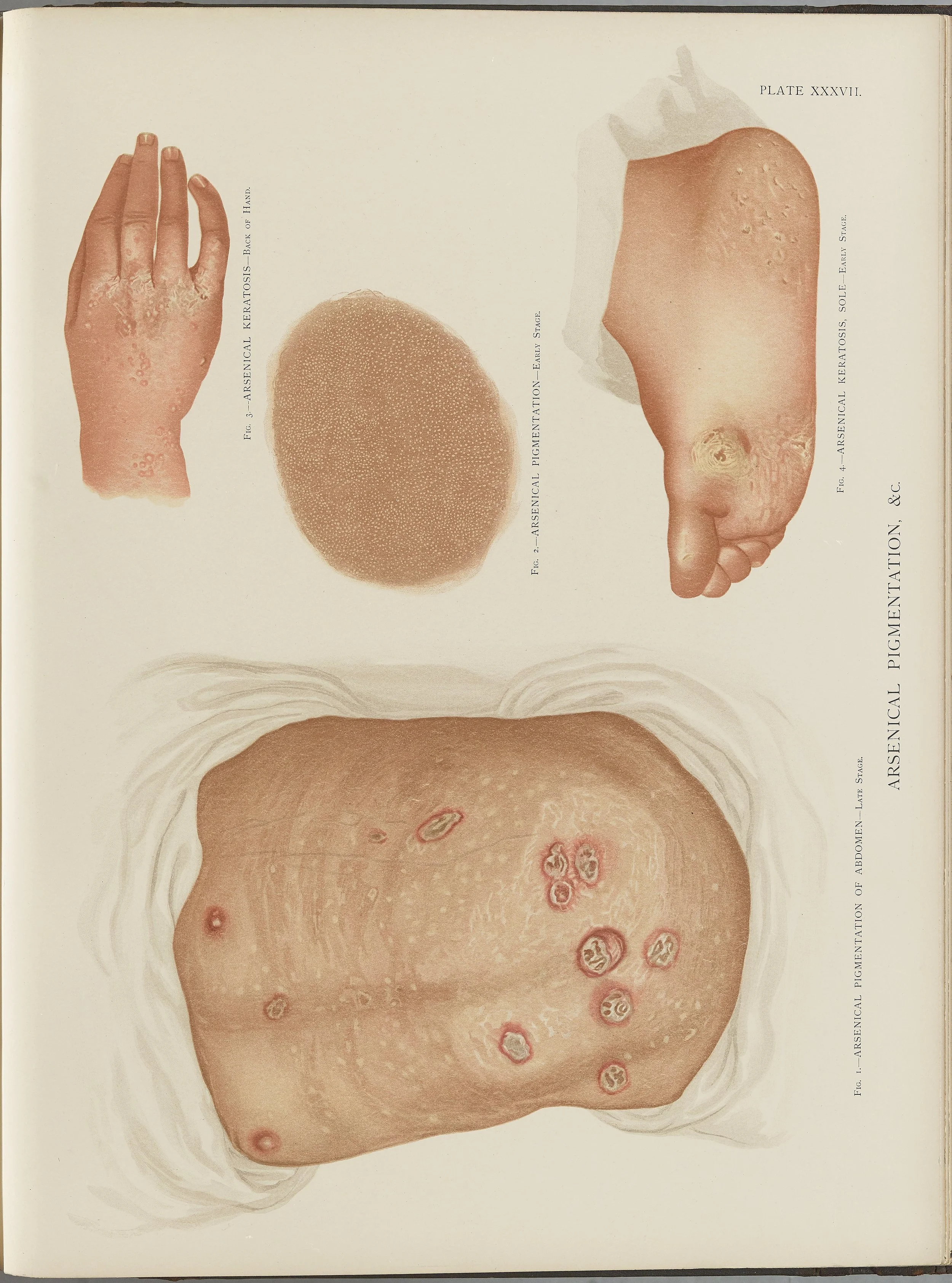 RM0164(Vol.i)_104.jpg