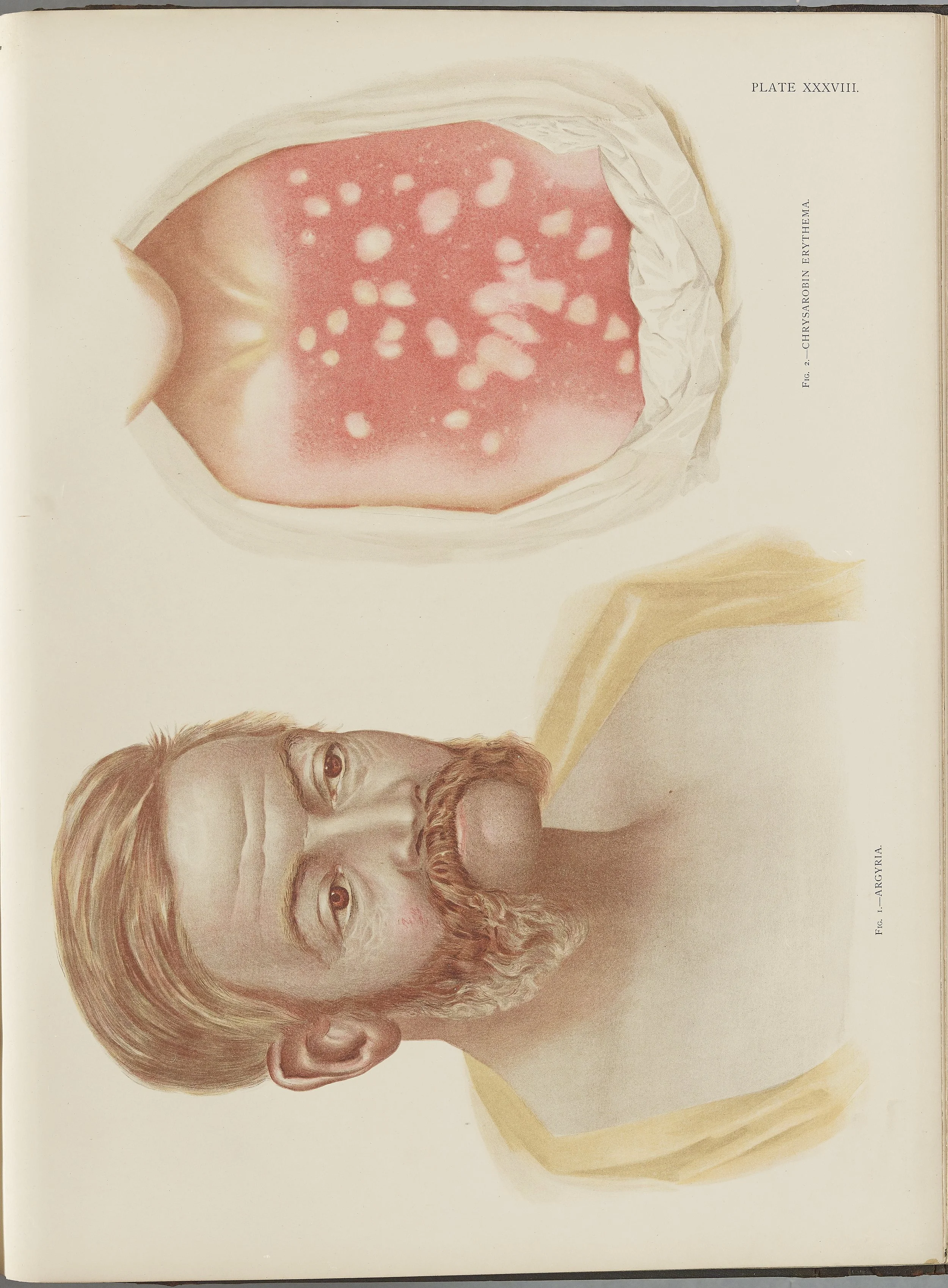 RM0164(Vol.i)_107.jpg