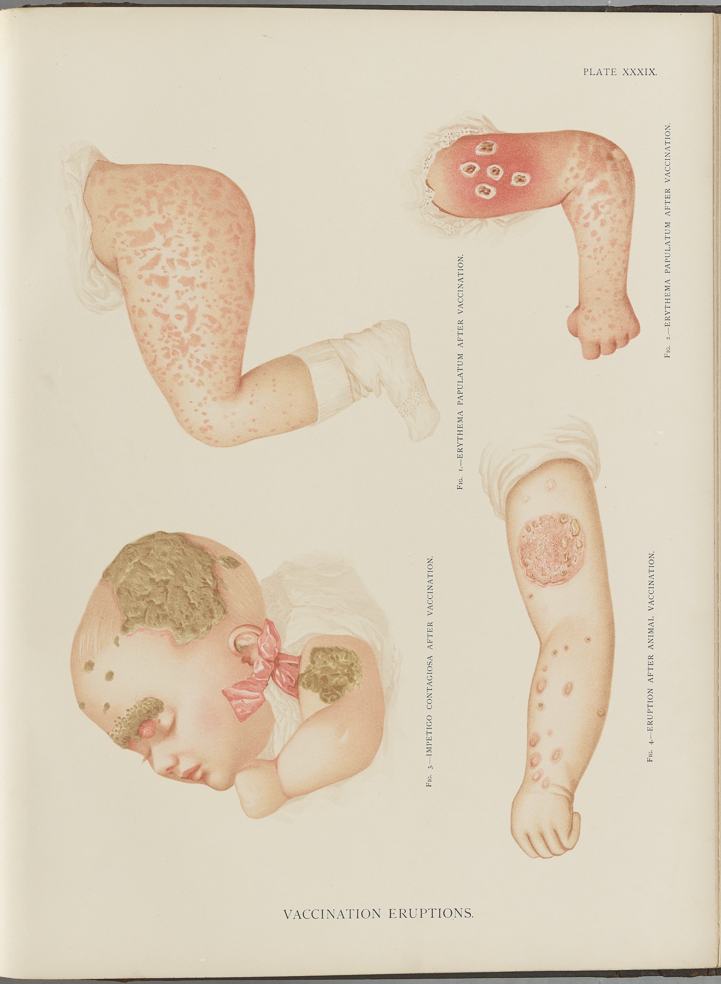RM0164(Vol.i)_110.jpg