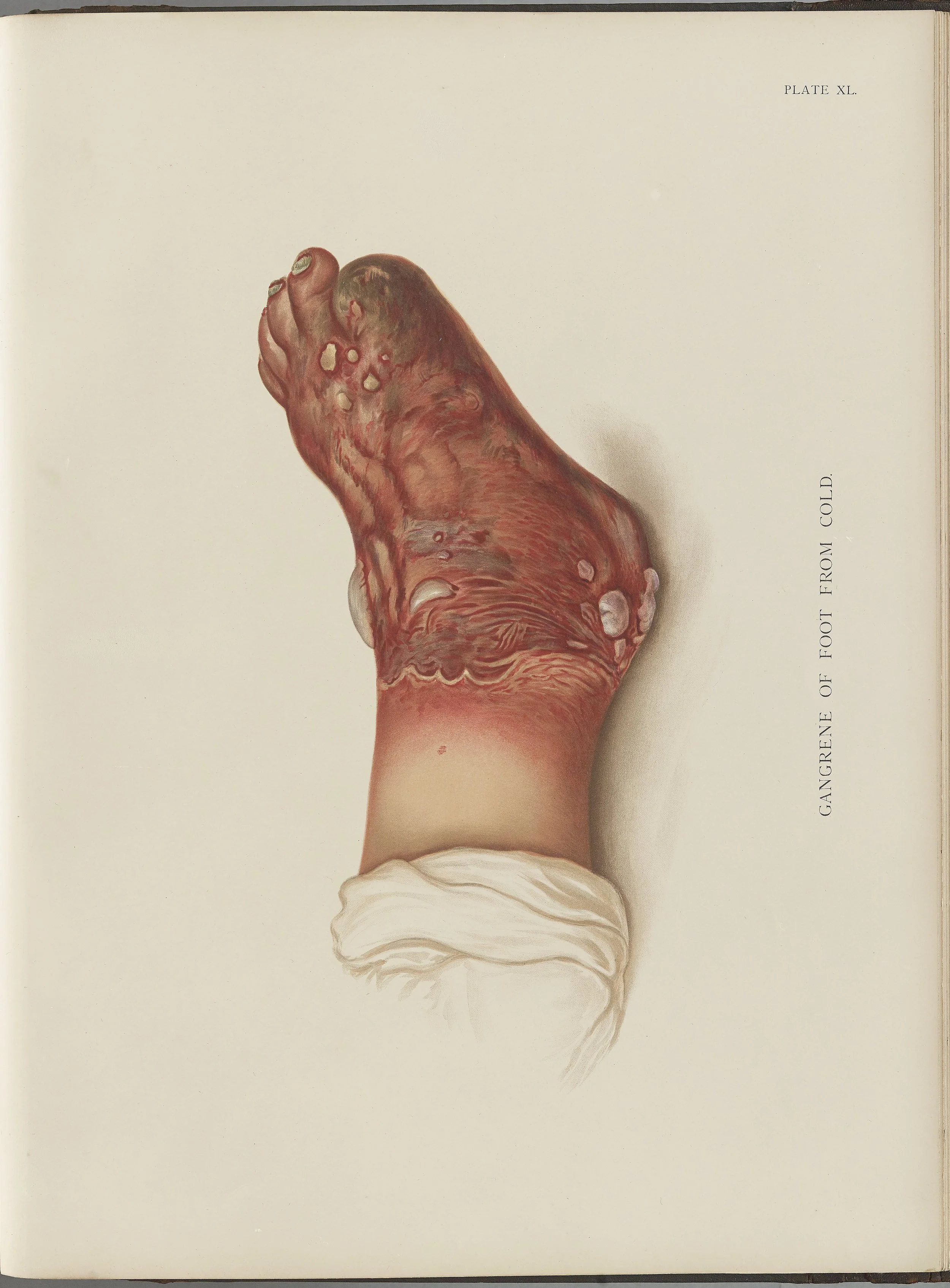 RM0164(Vol.i)_112.jpg