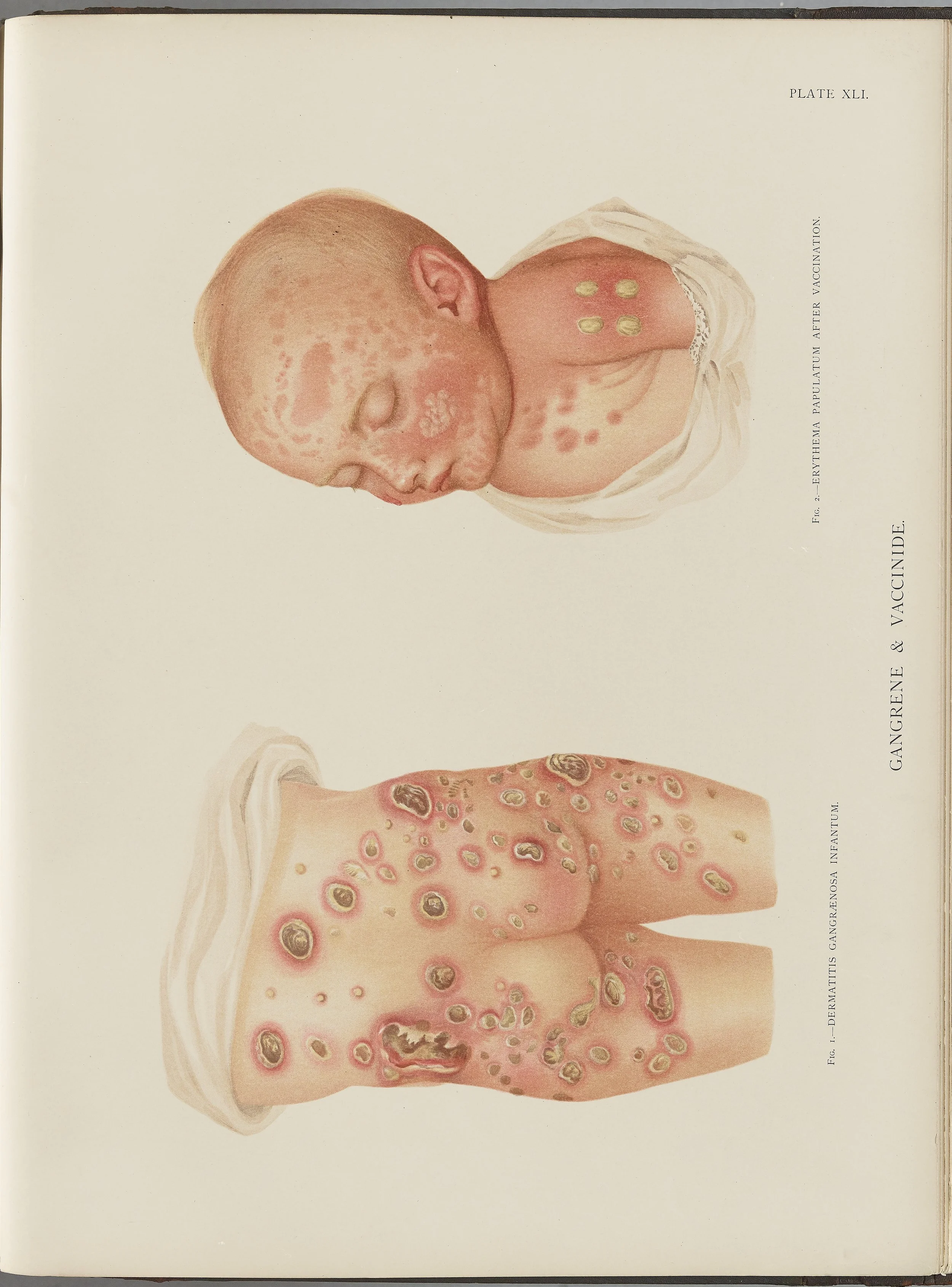 RM0164(Vol.i)_115.jpg