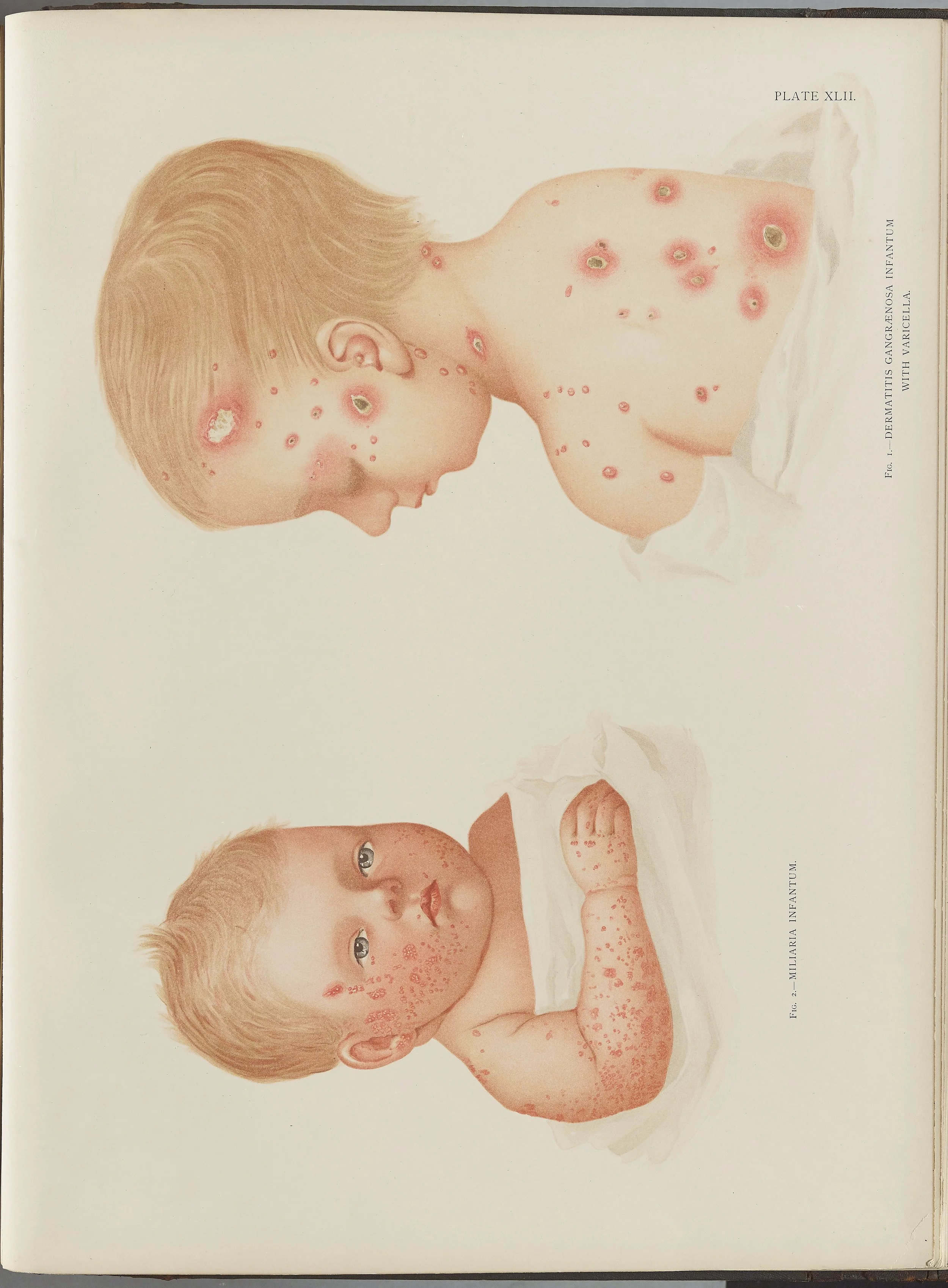 RM0164(Vol.i)_118.jpg