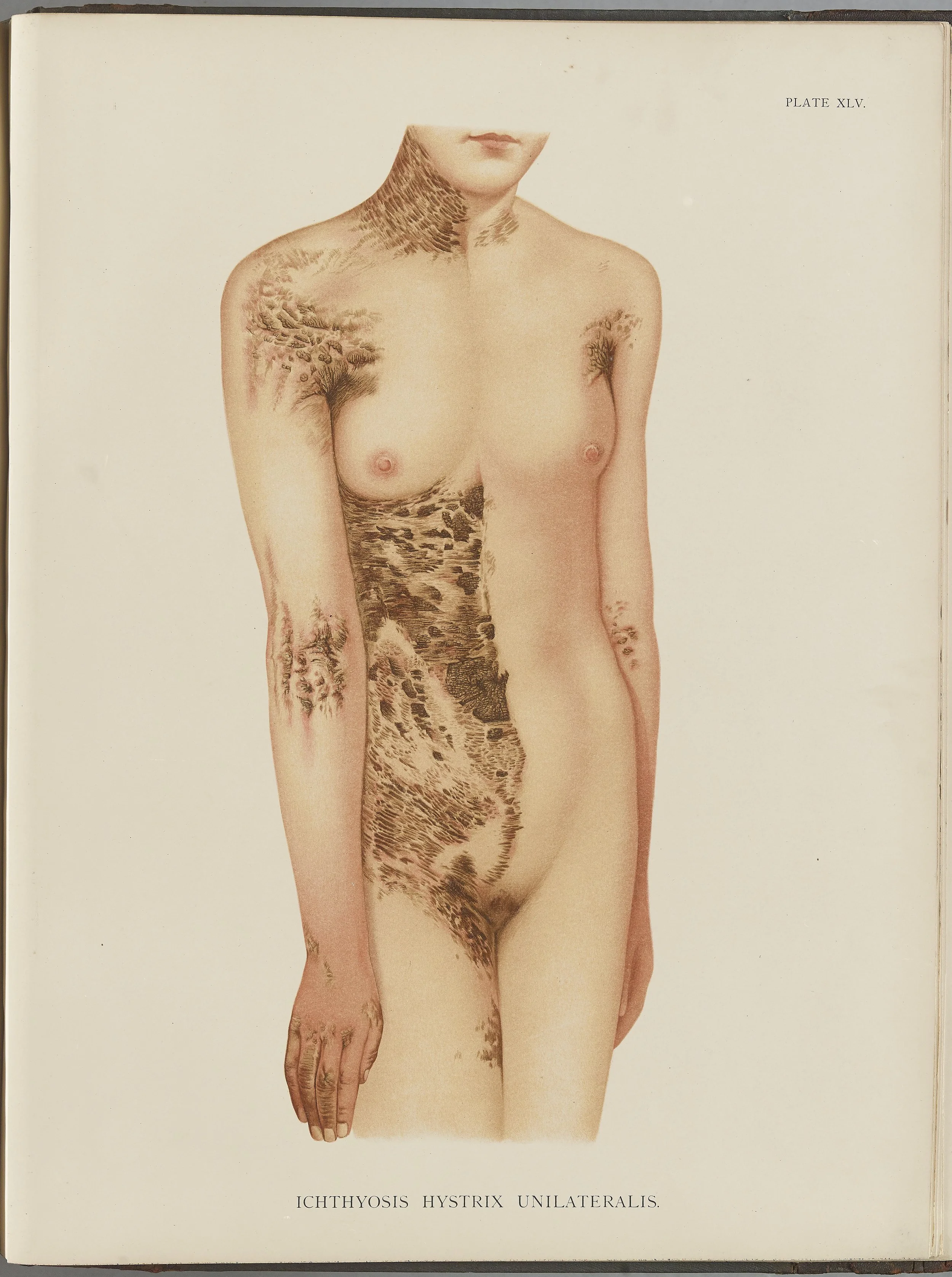 RM0164(Vol.i)_127.jpg