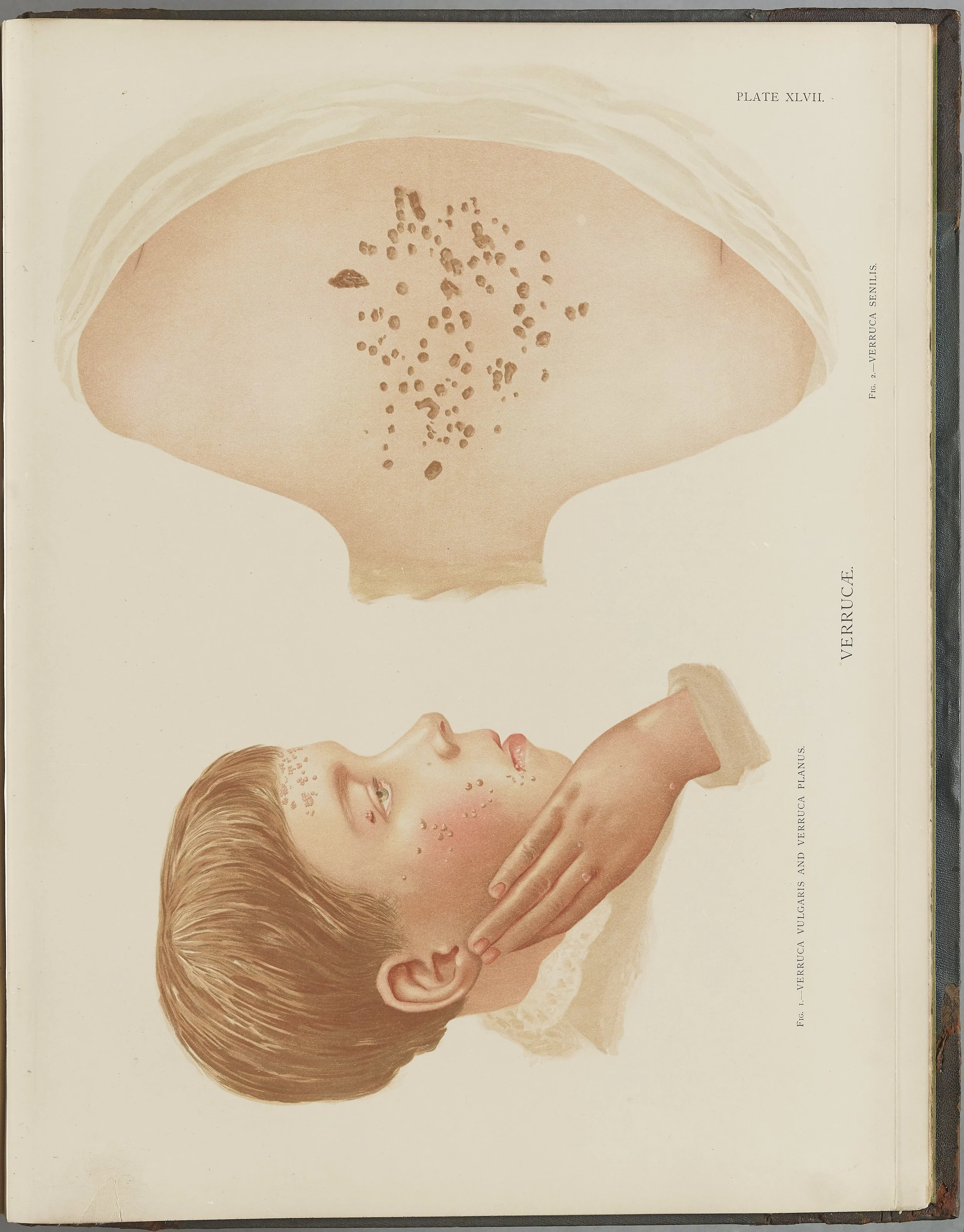 RM0164(Vol.i)_131.jpg