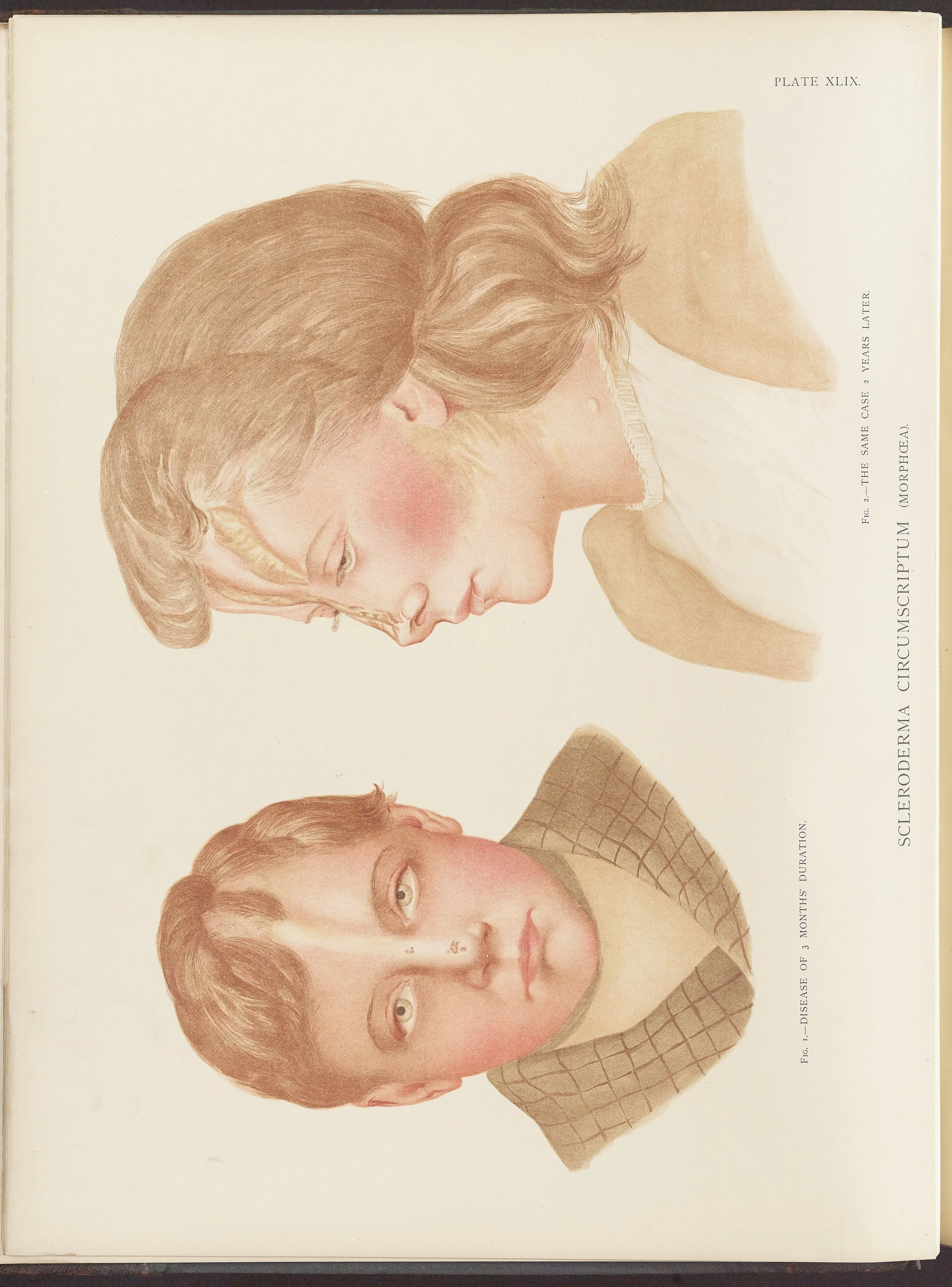 RM0164(Vol.ii)_10.jpg