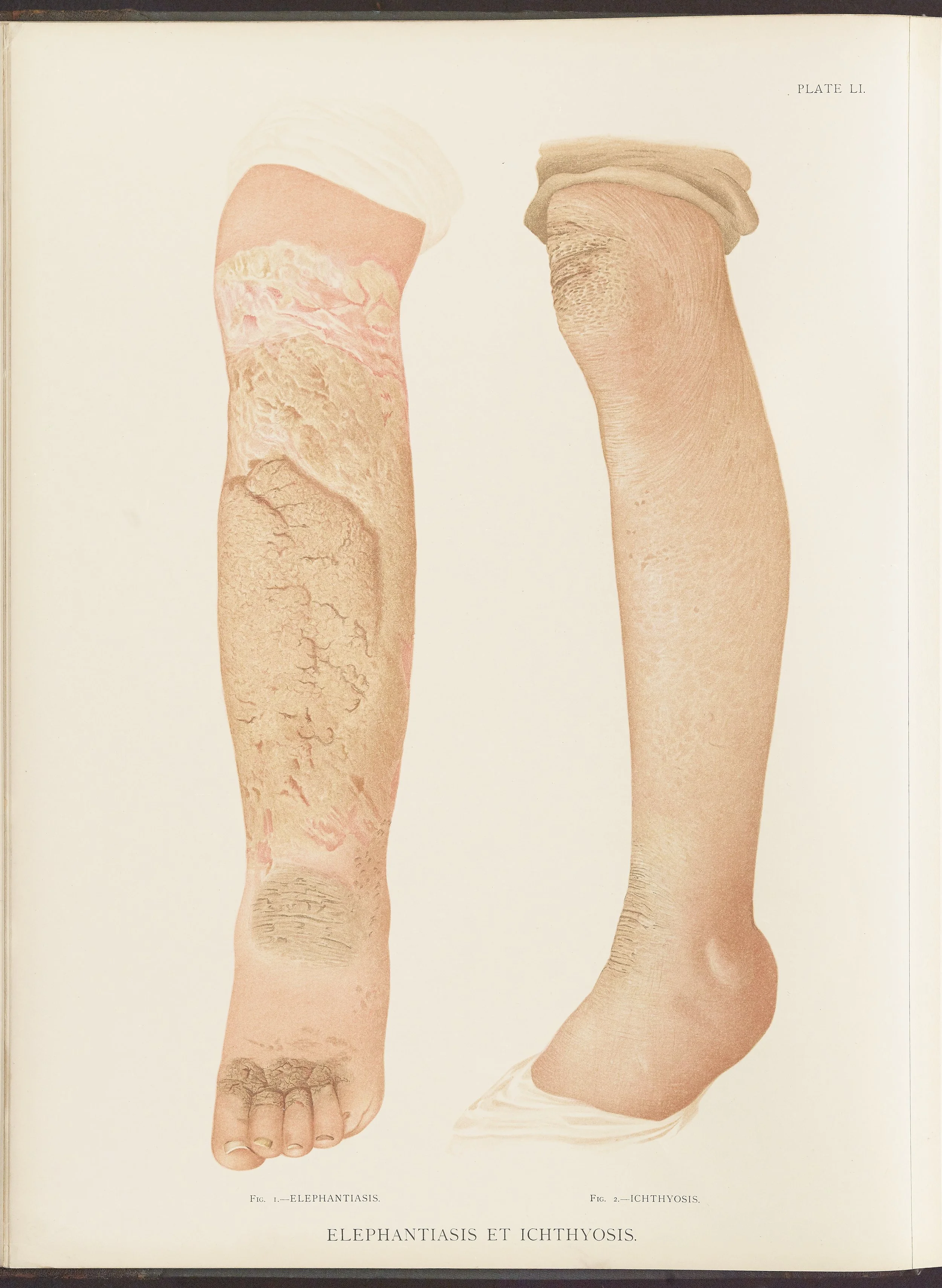 RM0164(Vol.ii)_16.jpg