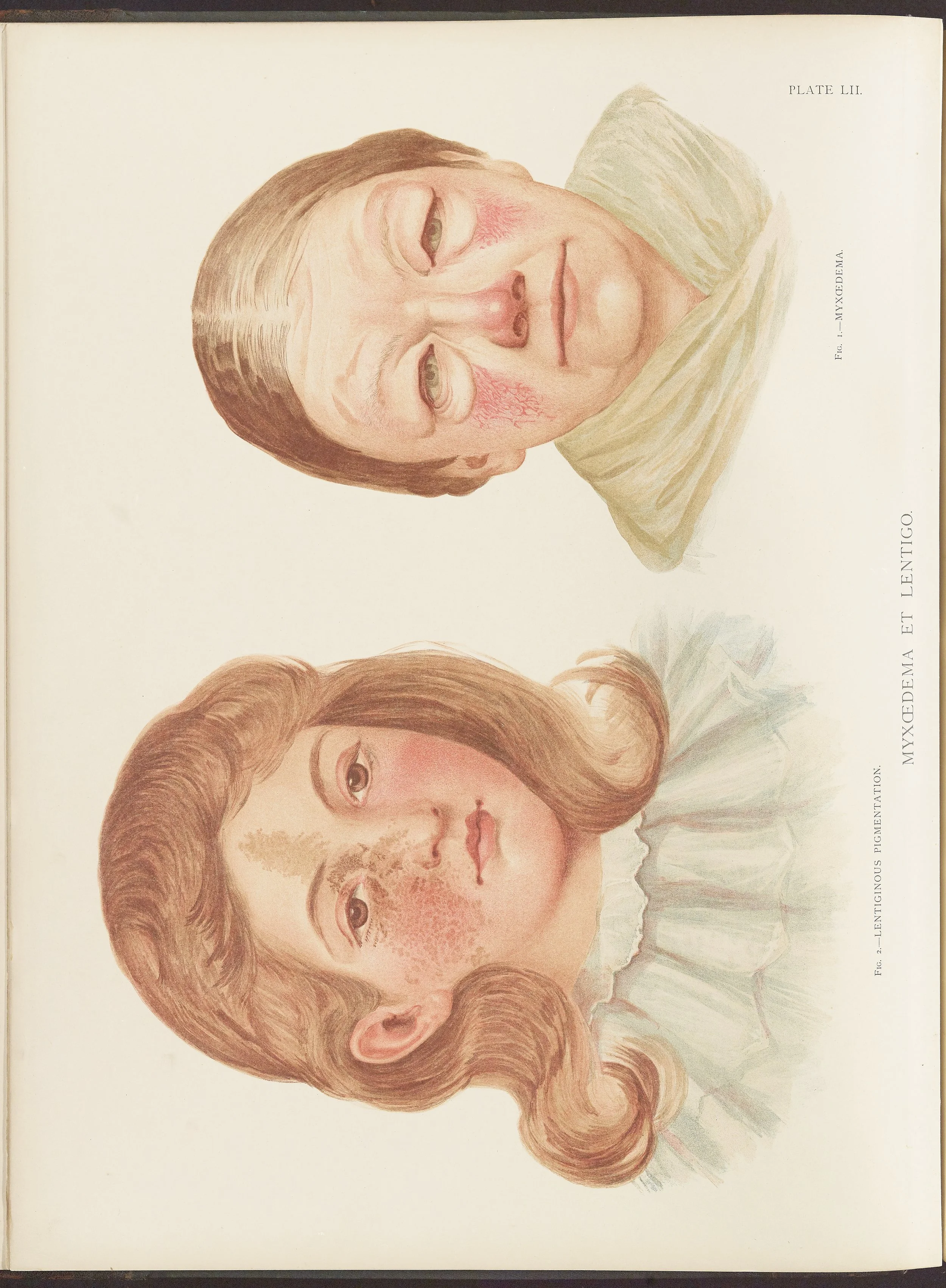 RM0164(Vol.ii)_18.jpg