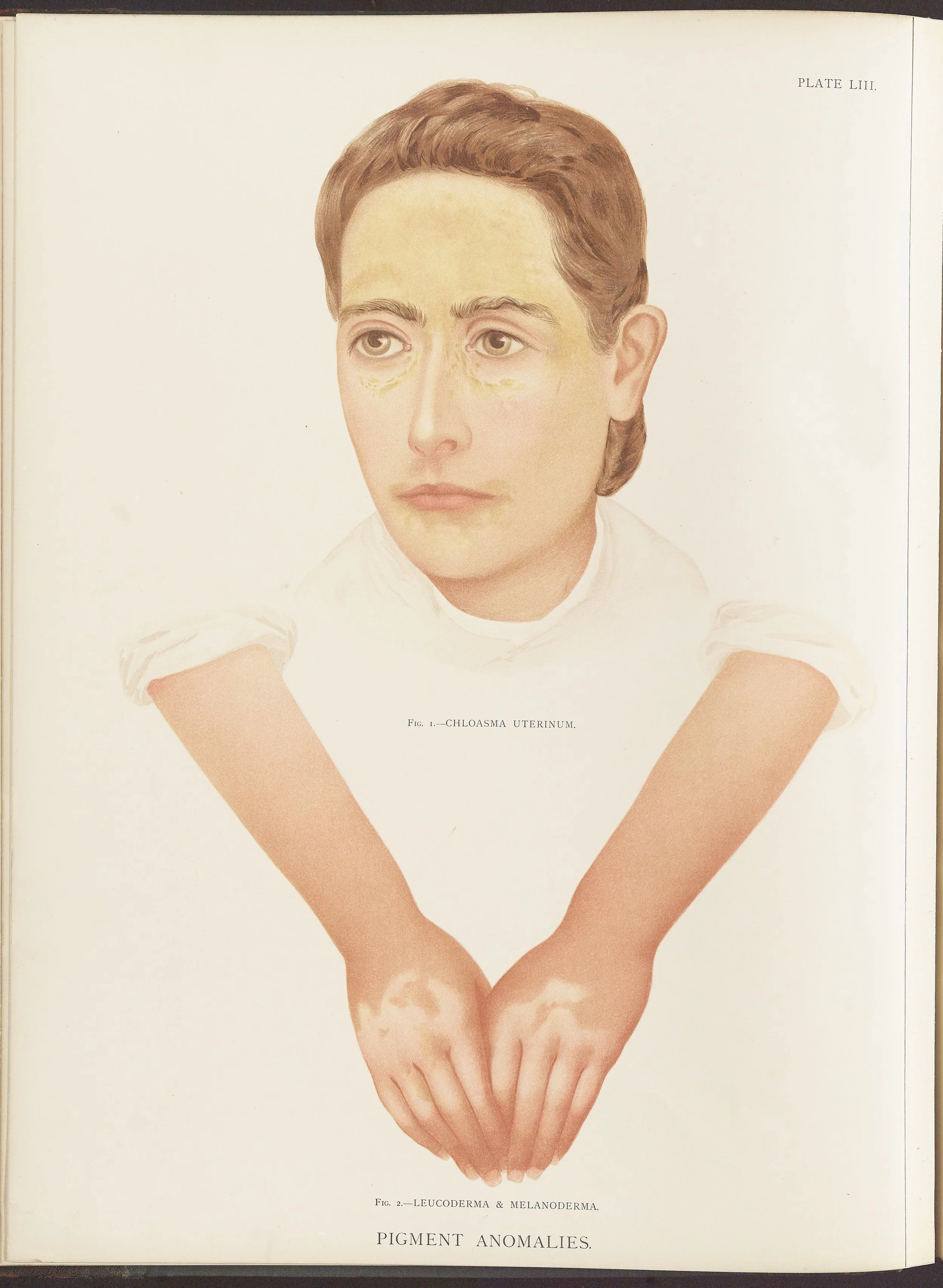 RM0164(Vol.ii)_20.jpg